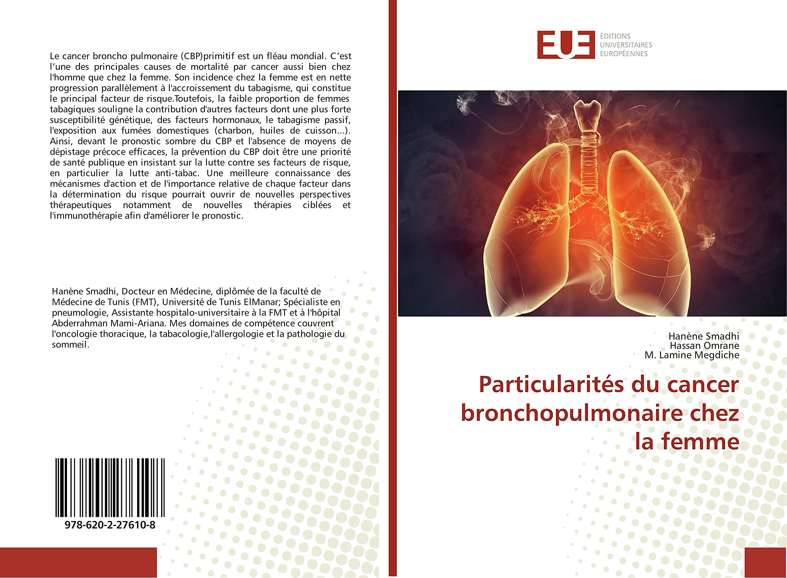 Particularités du cancer bronchopulmonaire chez la femme book
