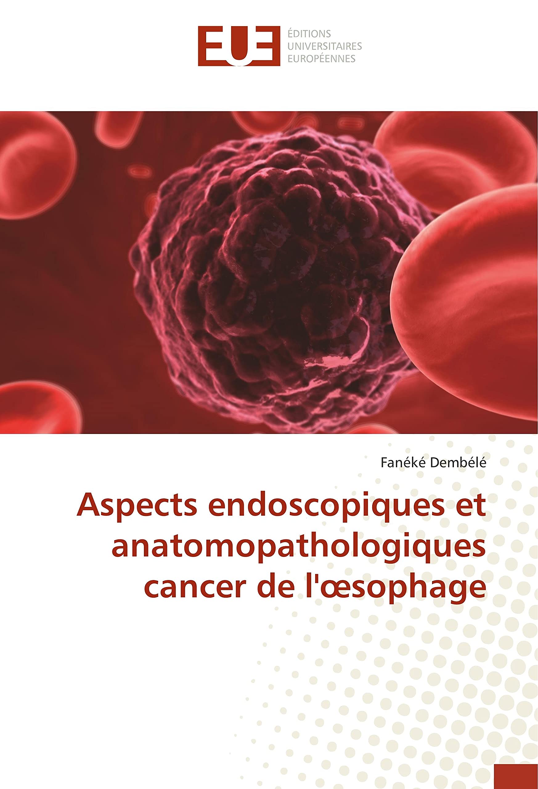 Aspects endoscopiques et anatomopathologiques cancer de l'œsophage book