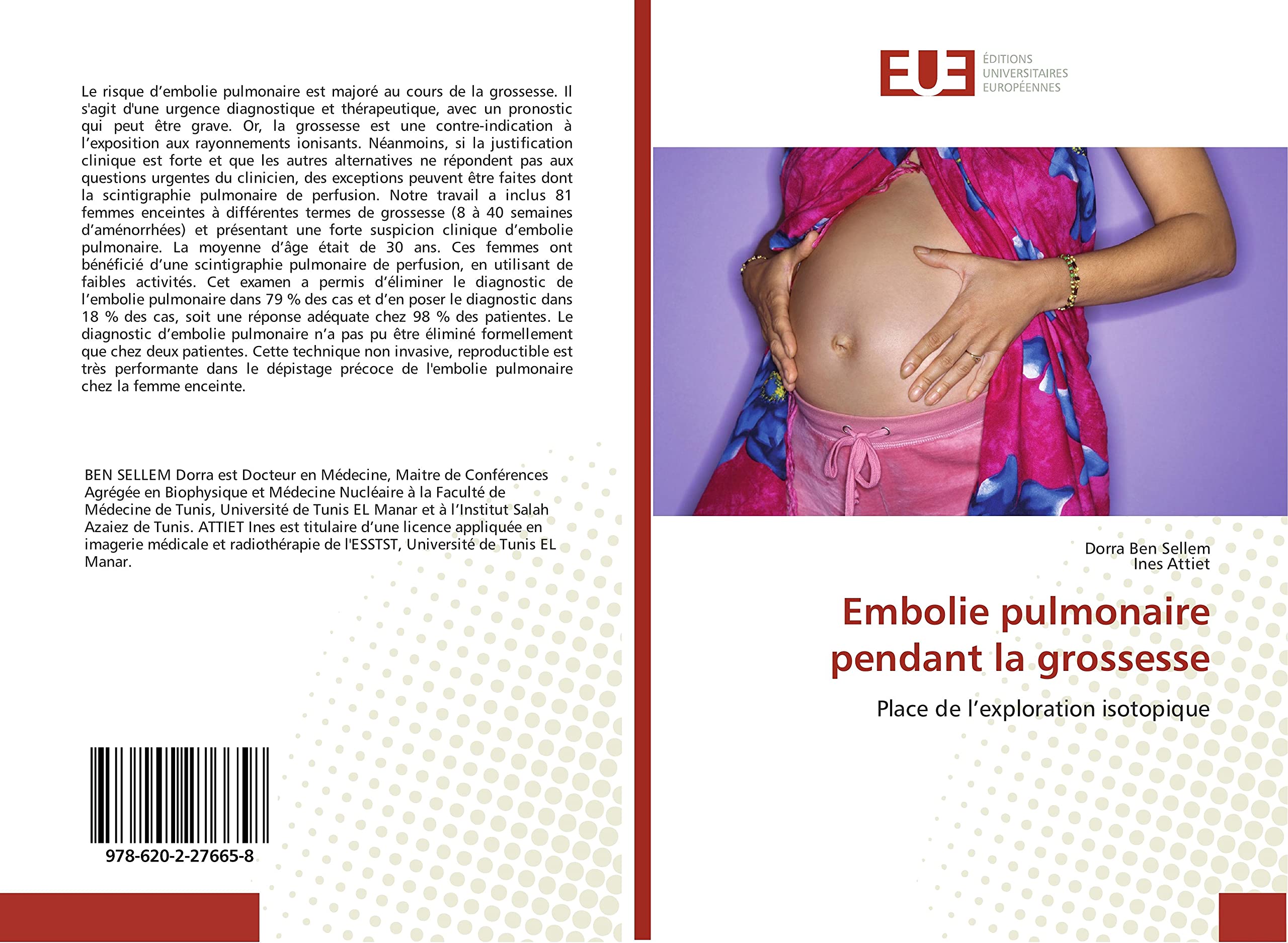 Embolie pulmonaire pendant la grossesse: Place de l’exploration isotopique book