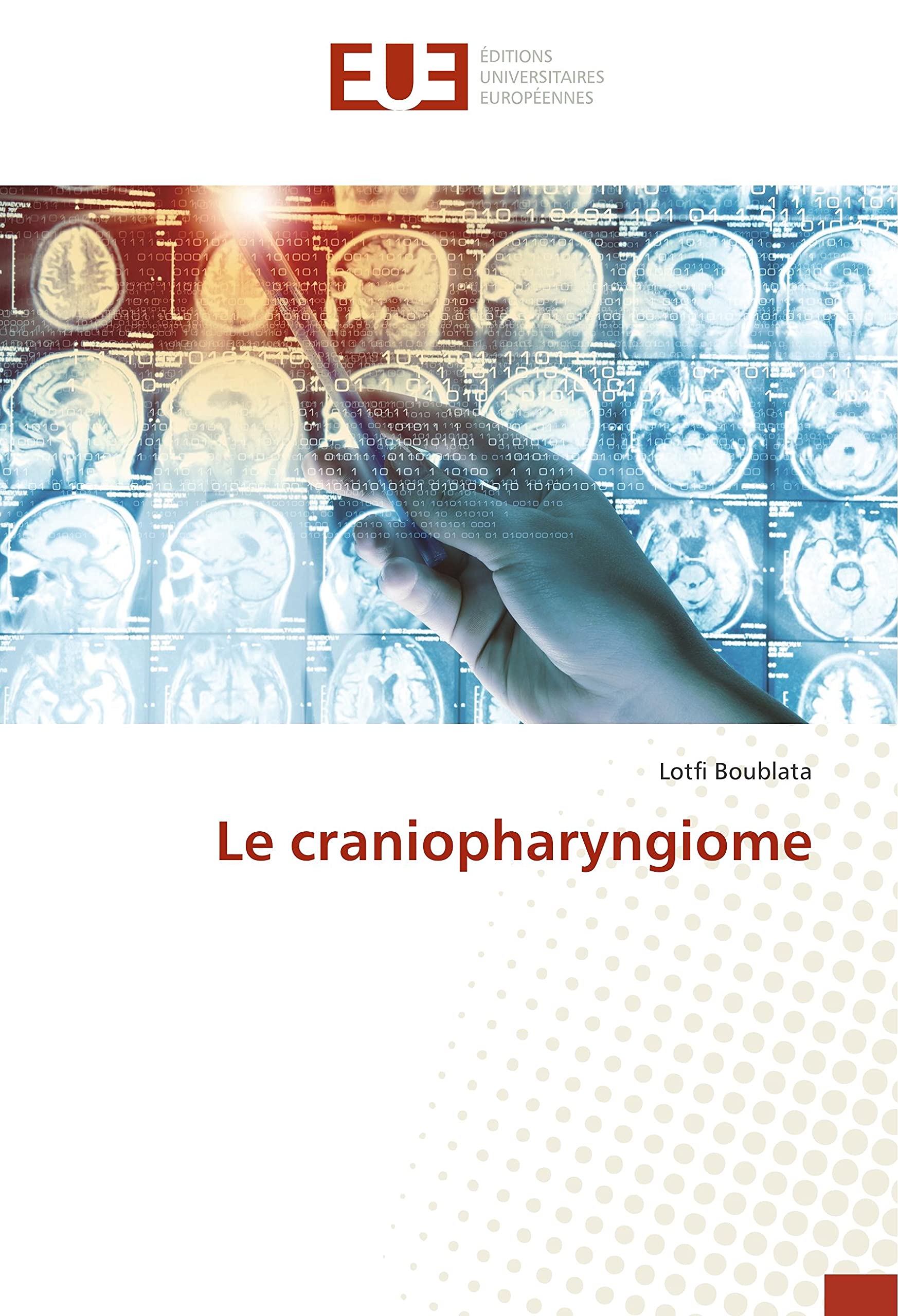 Le craniopharyngiome book
