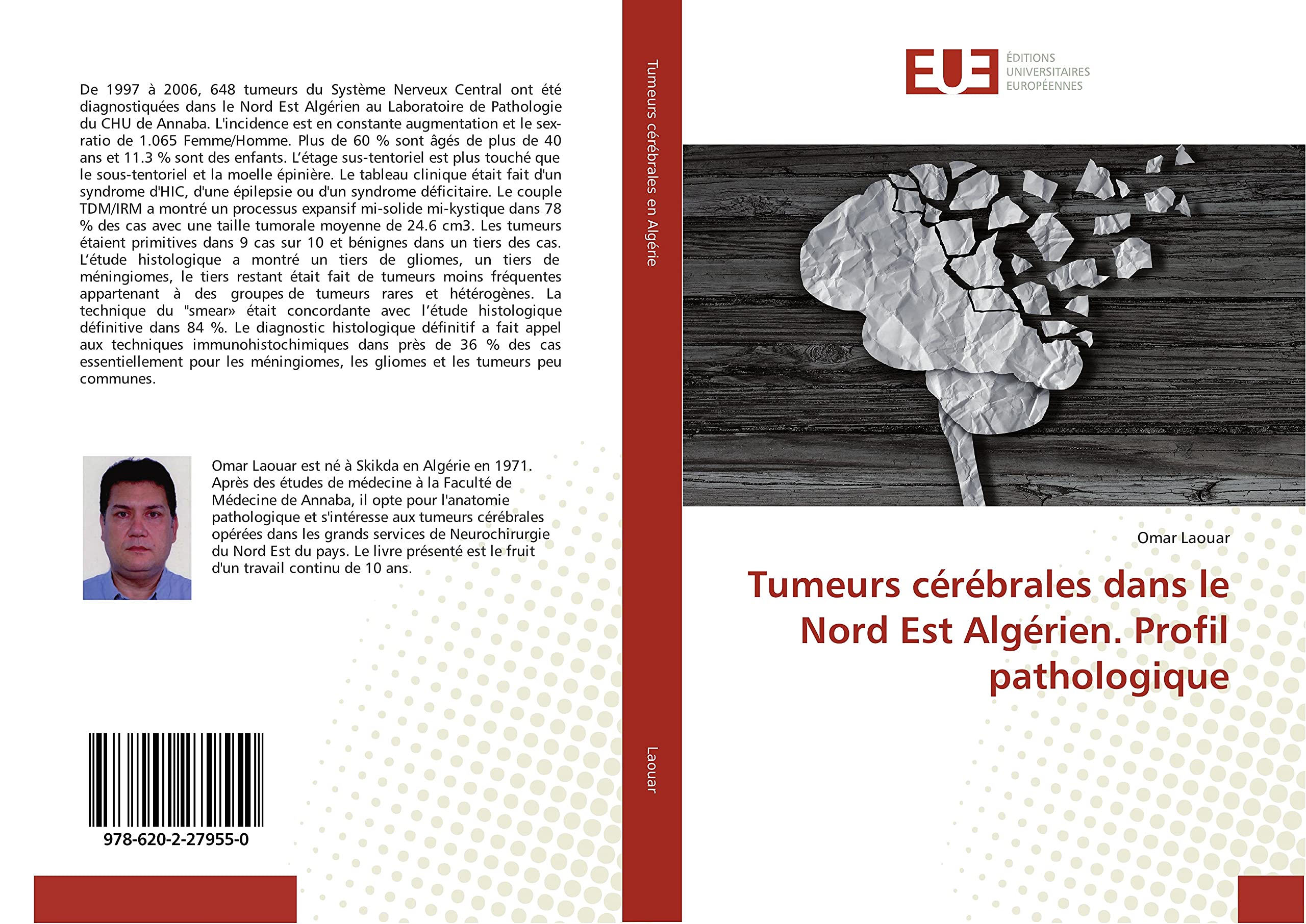 Tumeurs cérébrales dans le Nord Est Algérien. Profil pathologique book