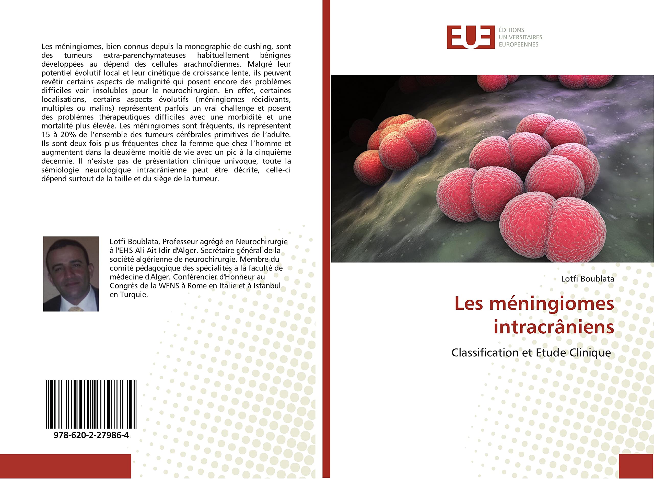 Les méningiomes intracrâniens: Classification et Etude Clinique book