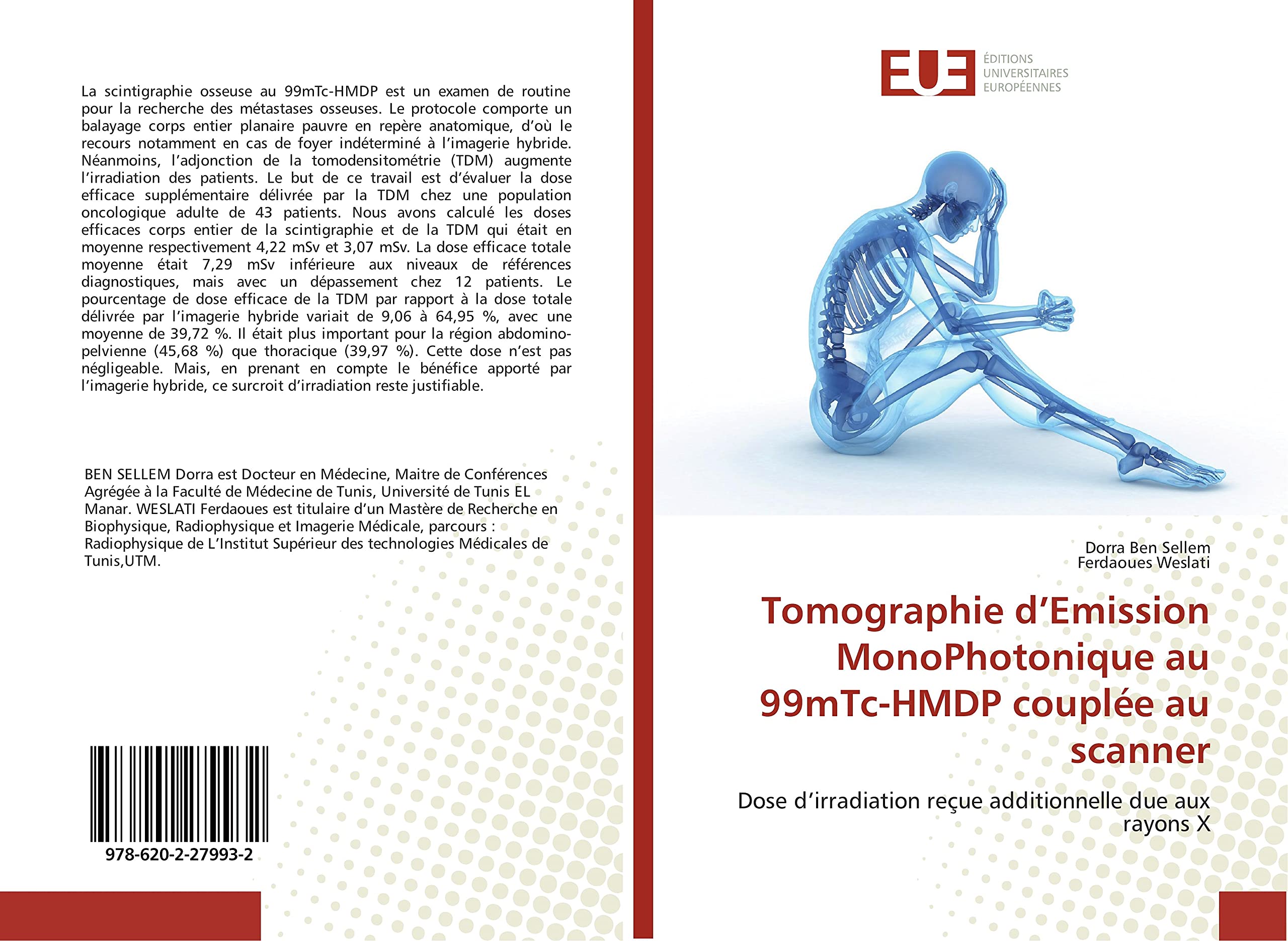 Tomographie d’Emission MonoPhotonique au 99mTc-HMDP couplée au scanner: Dose d’irradiation reçue additionnelle due aux rayons X book