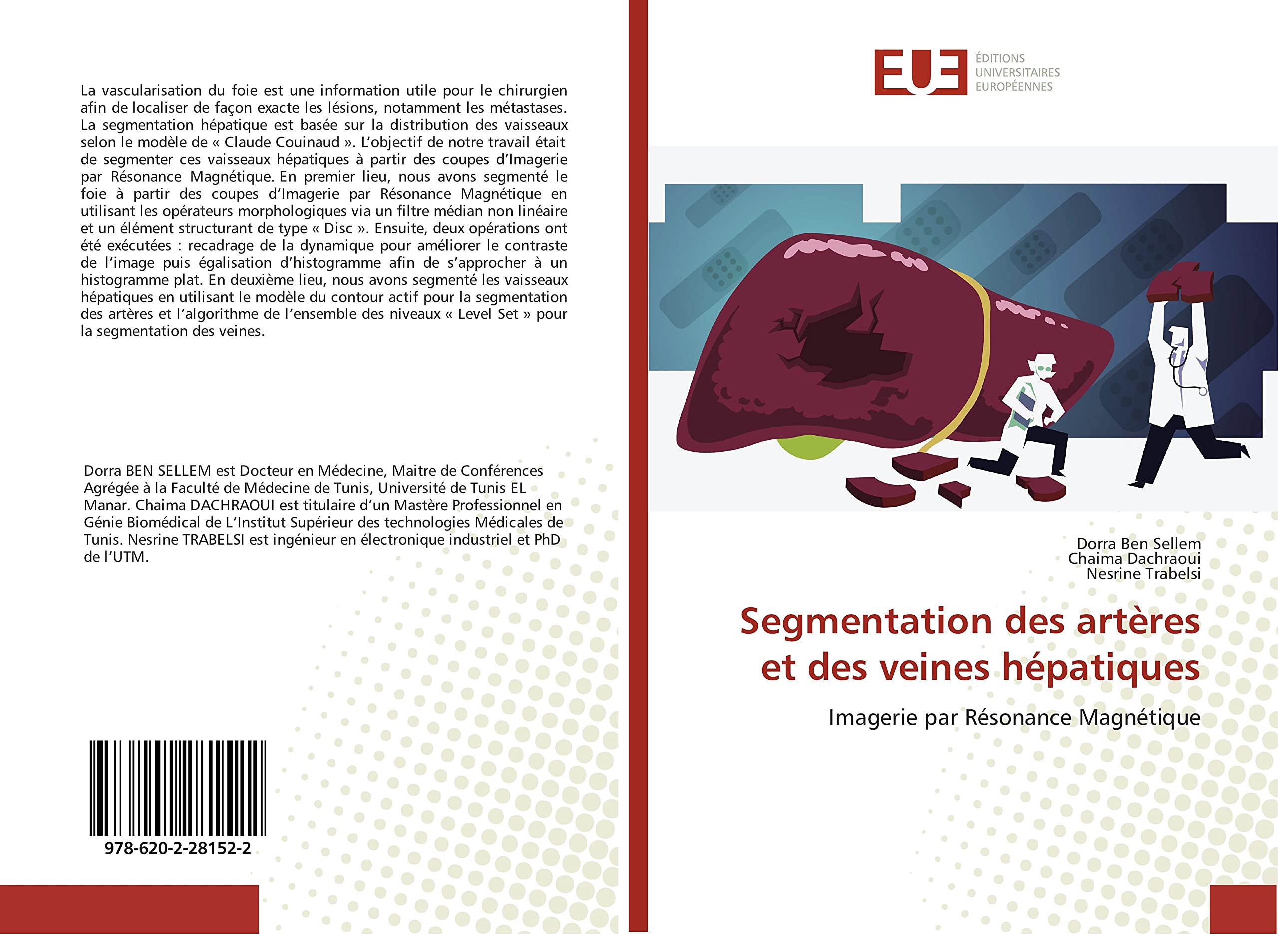 Segmentation des artères et des veines hépatiques: Imagerie par Résonance Magnétique book