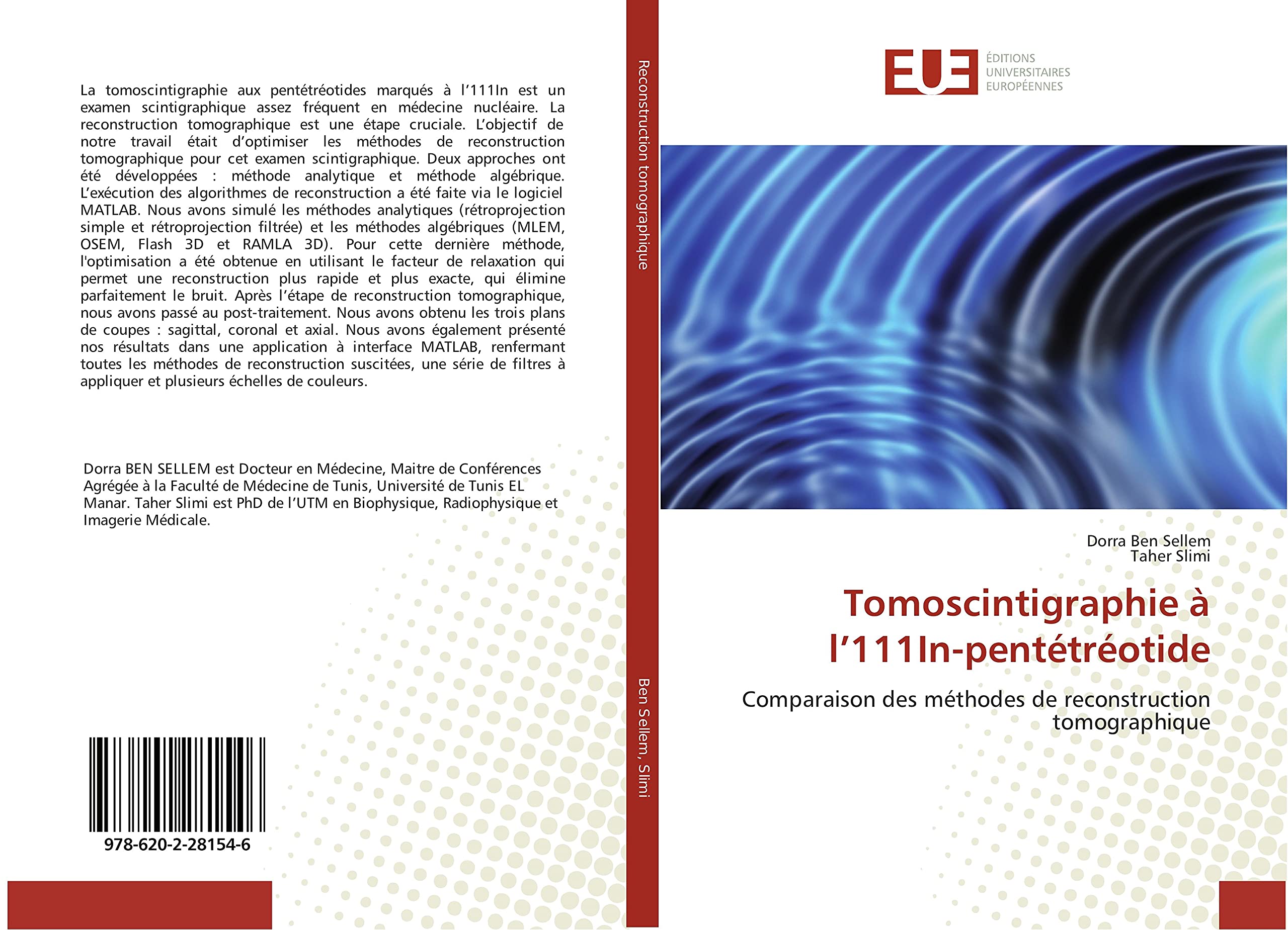 Tomoscintigraphie à l'111In-pentétréotide book