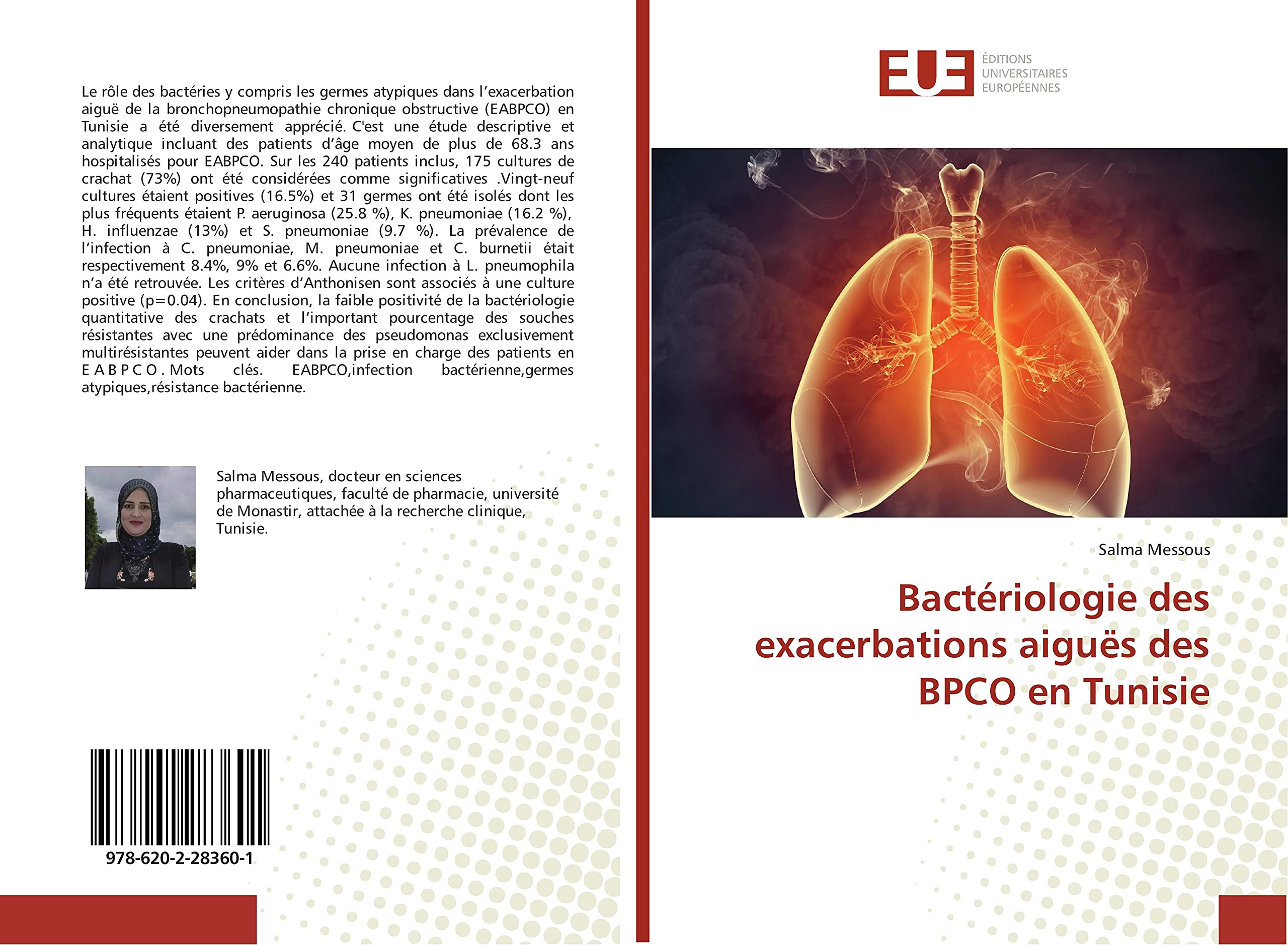 Bacteriologie des exacerbations aiguës des BPCO en Tunisie book