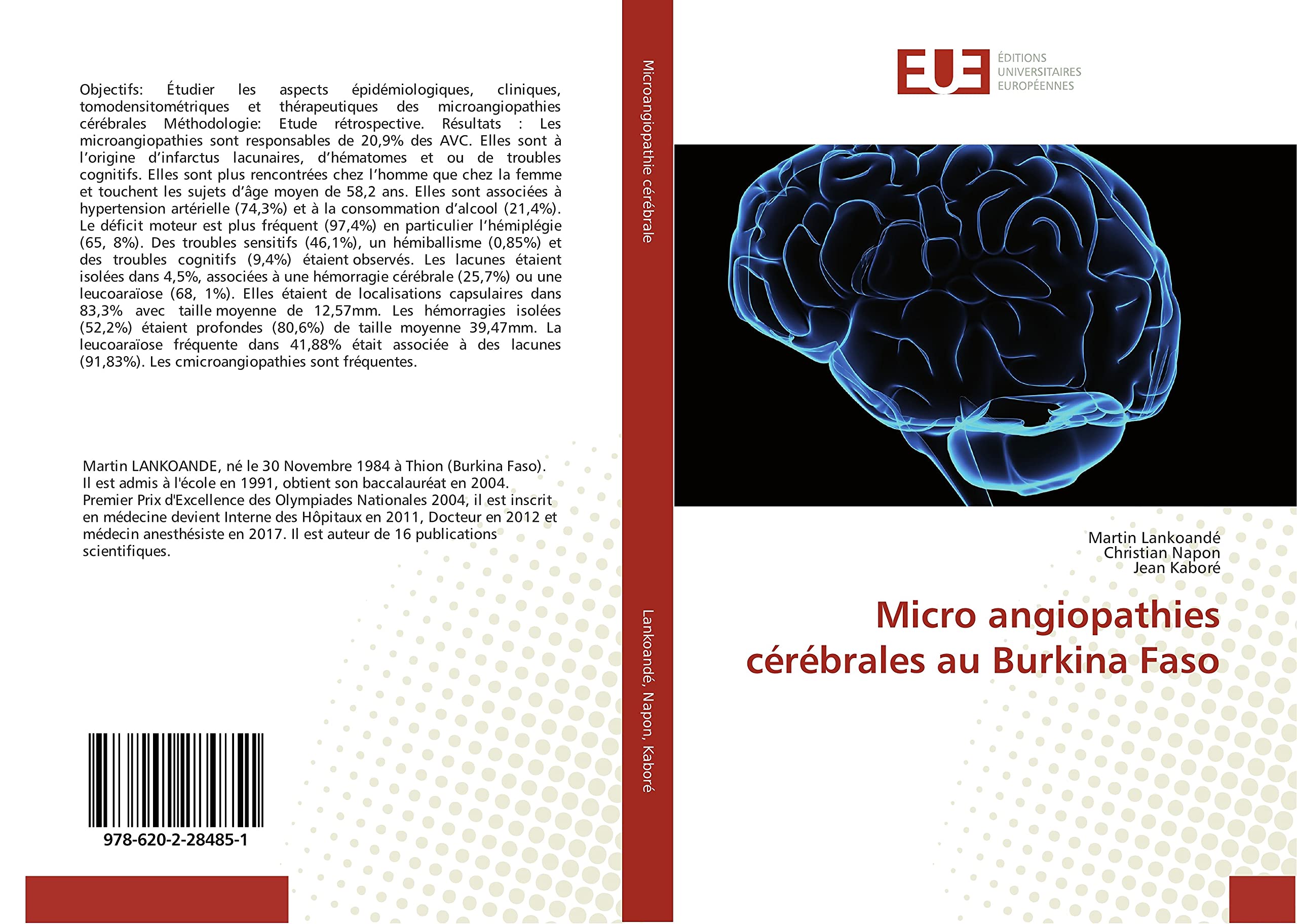 Micro angiopathies cérébrales au Burkina Faso book