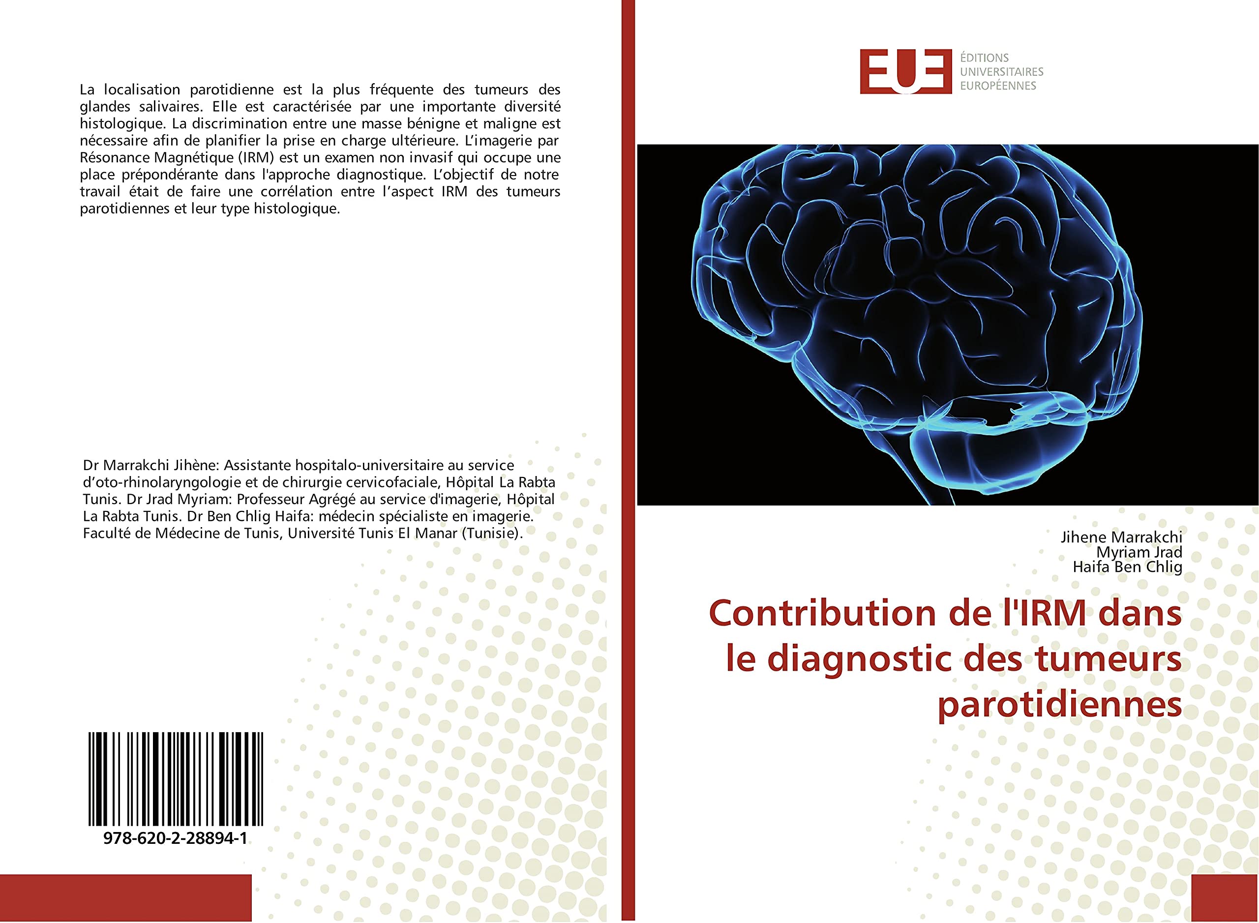 Contribution de l'IRM dans le diagnostic des tumeurs parotidiennes book