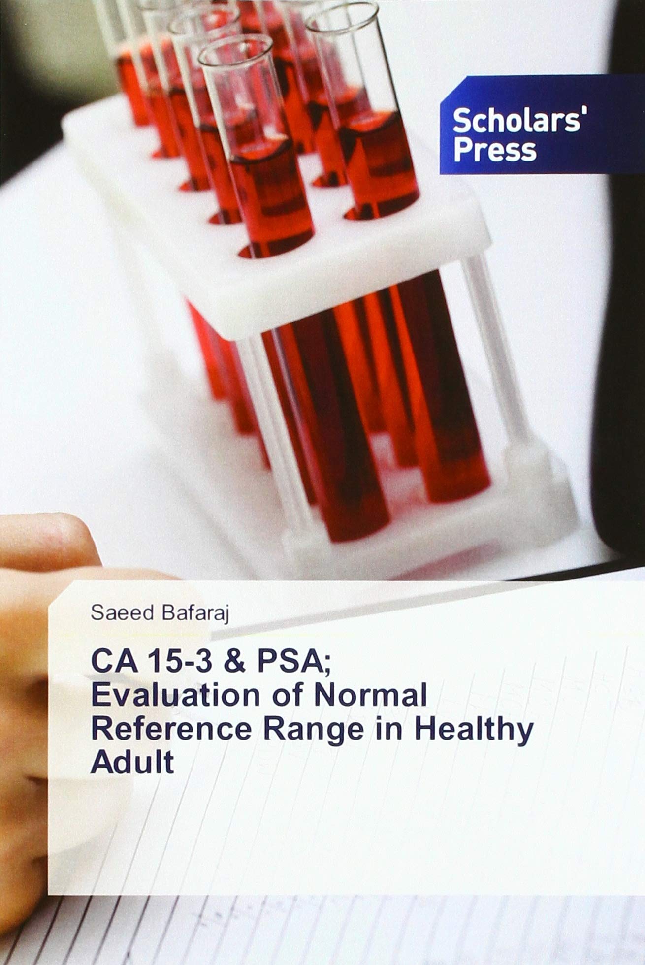 CA 15-3 & PSA; Evaluation of Normal Reference Range in Healthy Adult book