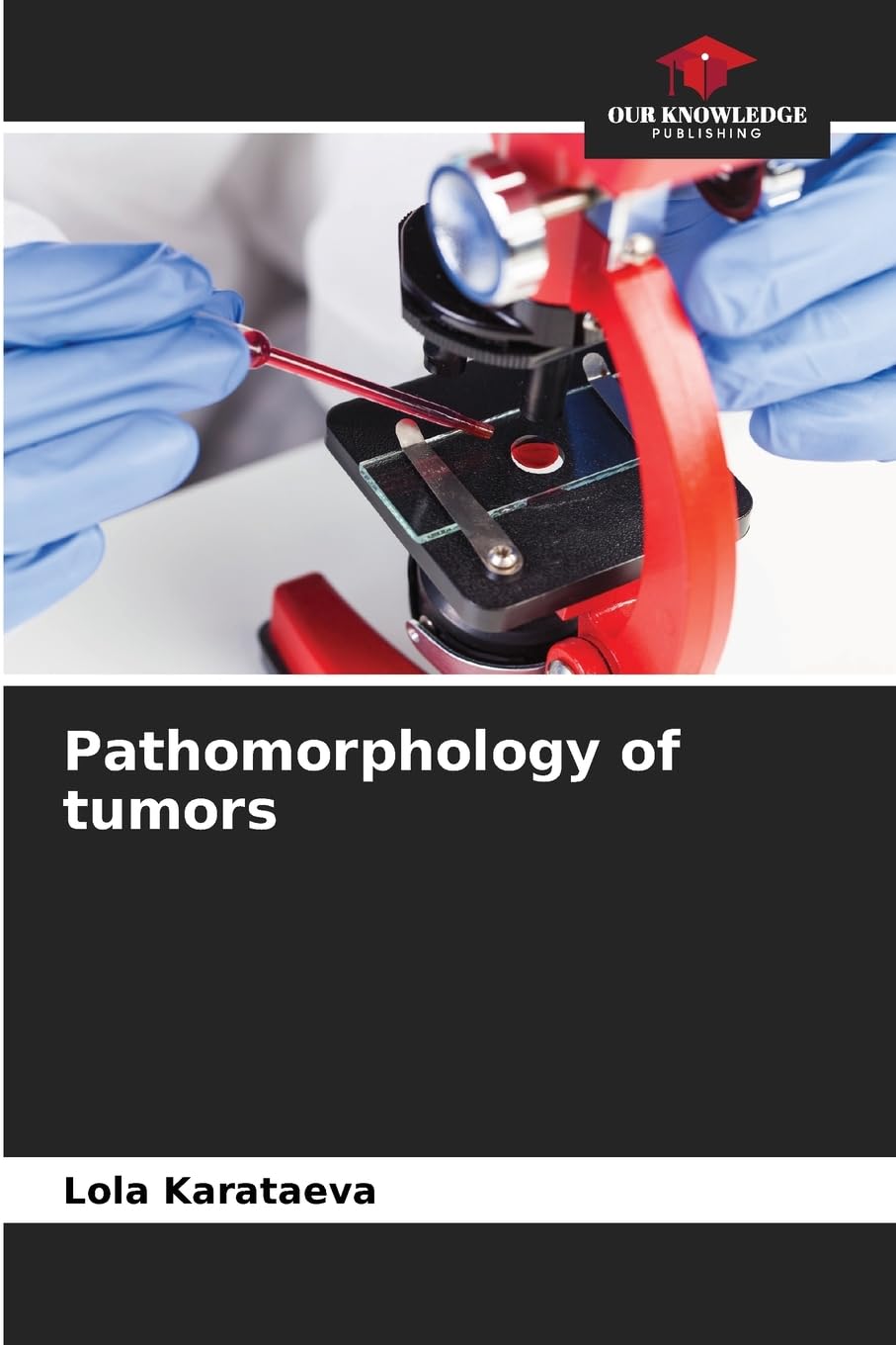 Pathomorphology of tumors Medicine