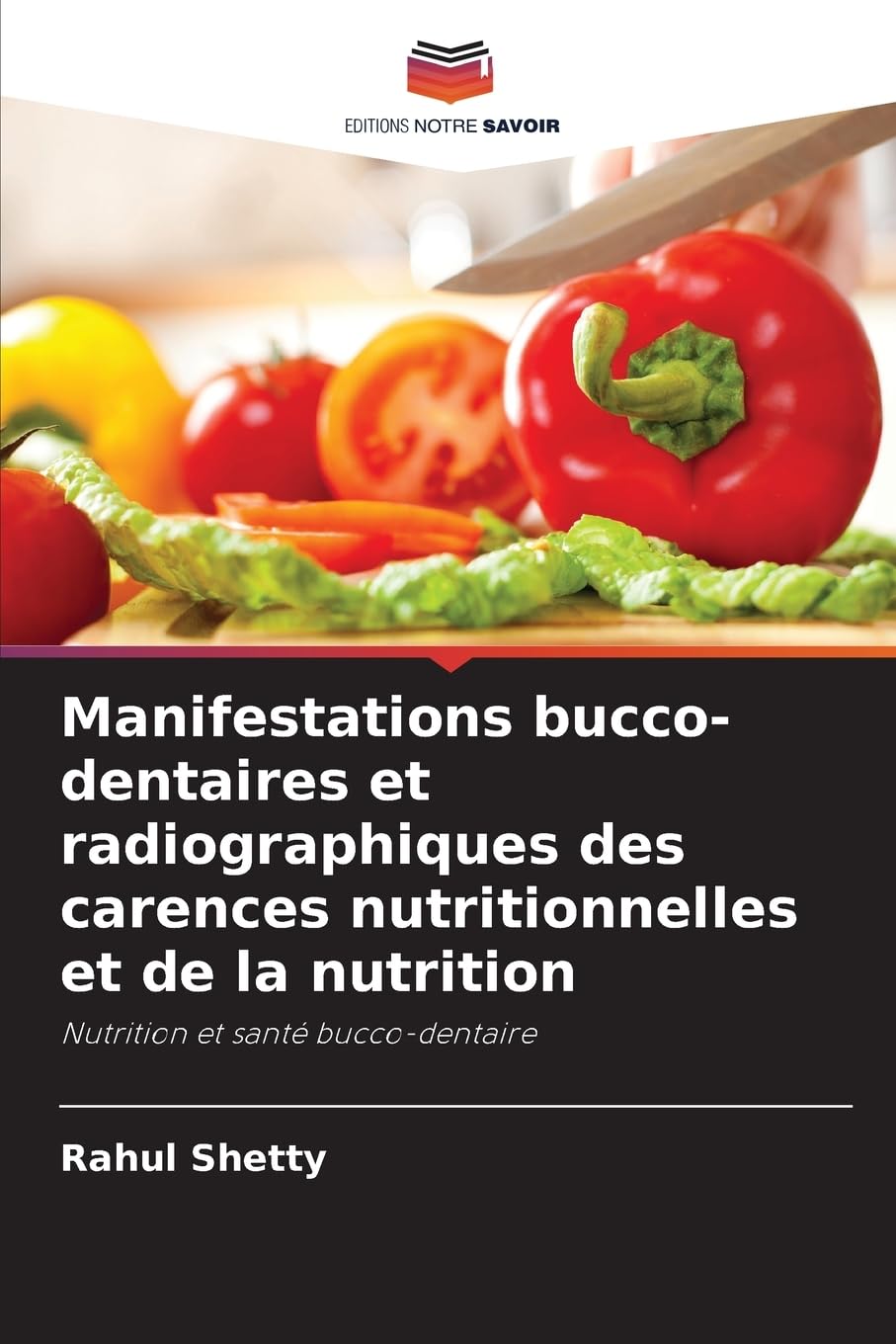 Manifestations bucco-dentaires et radiographiques des carences nutritionnelles et de la nutrition Medicine