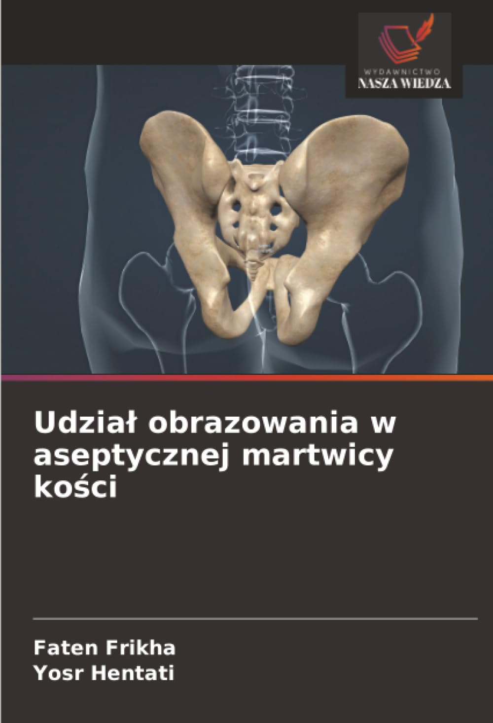 Udzia¿ obrazowania w aseptycznej martwicy ko¿ci Medicine