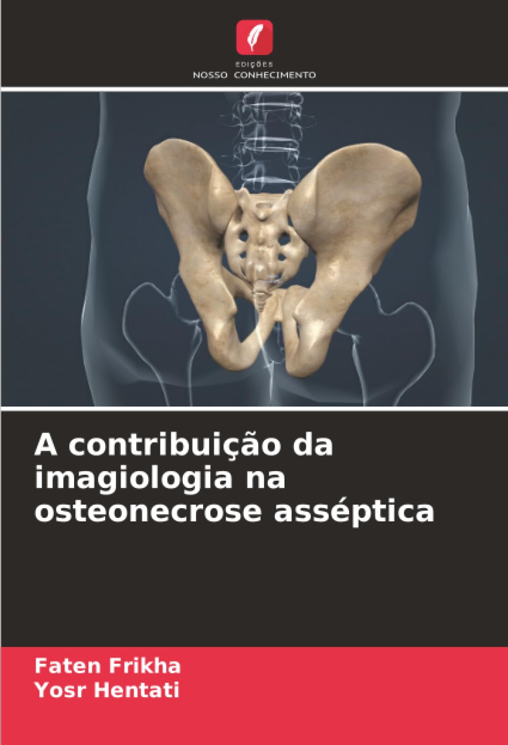 A contribuição da imagiologia na osteonecrose asséptica Medicine