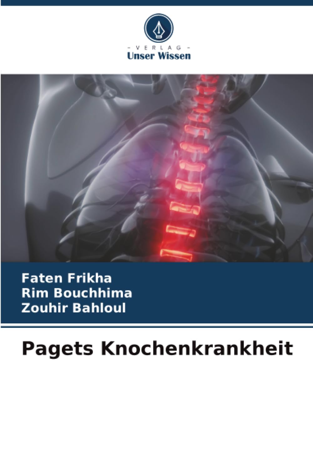 Pagets Knochenkrankheit Medicine