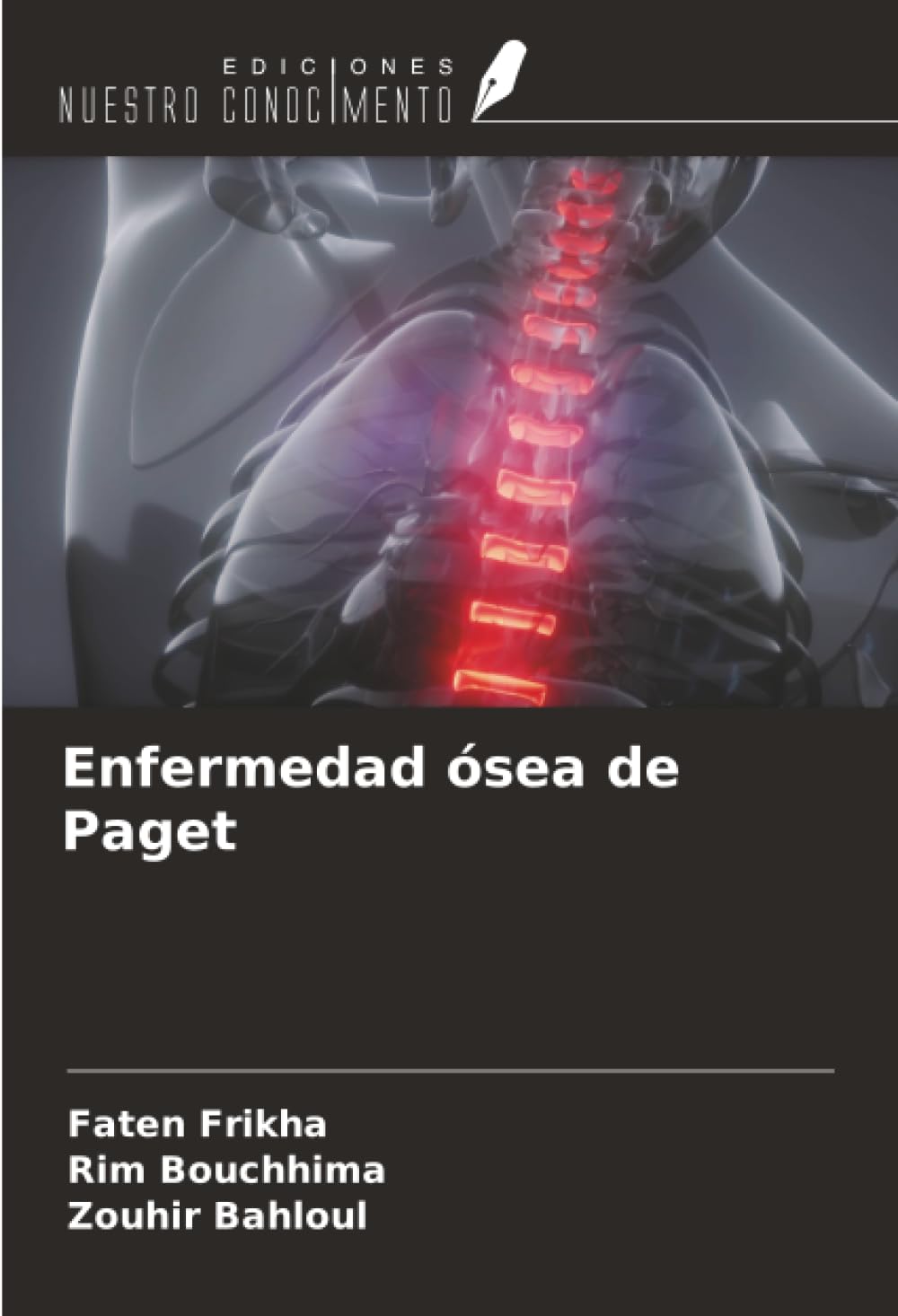 Enfermedad ósea de Paget Medicine