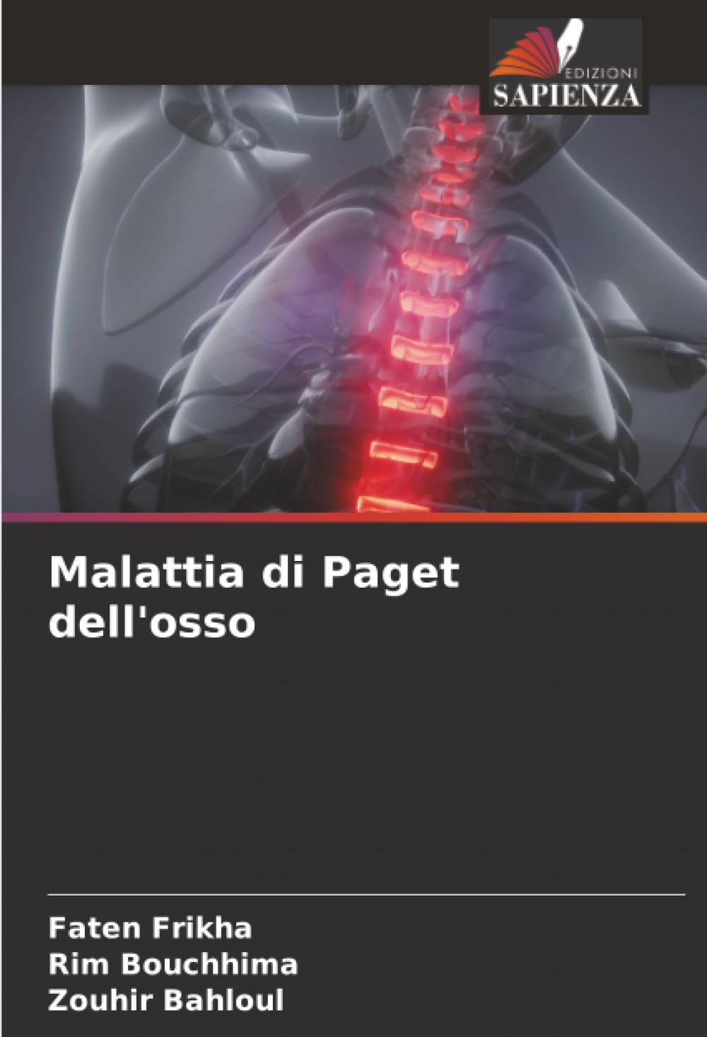 Malattia di Paget dell'osso Medicine
