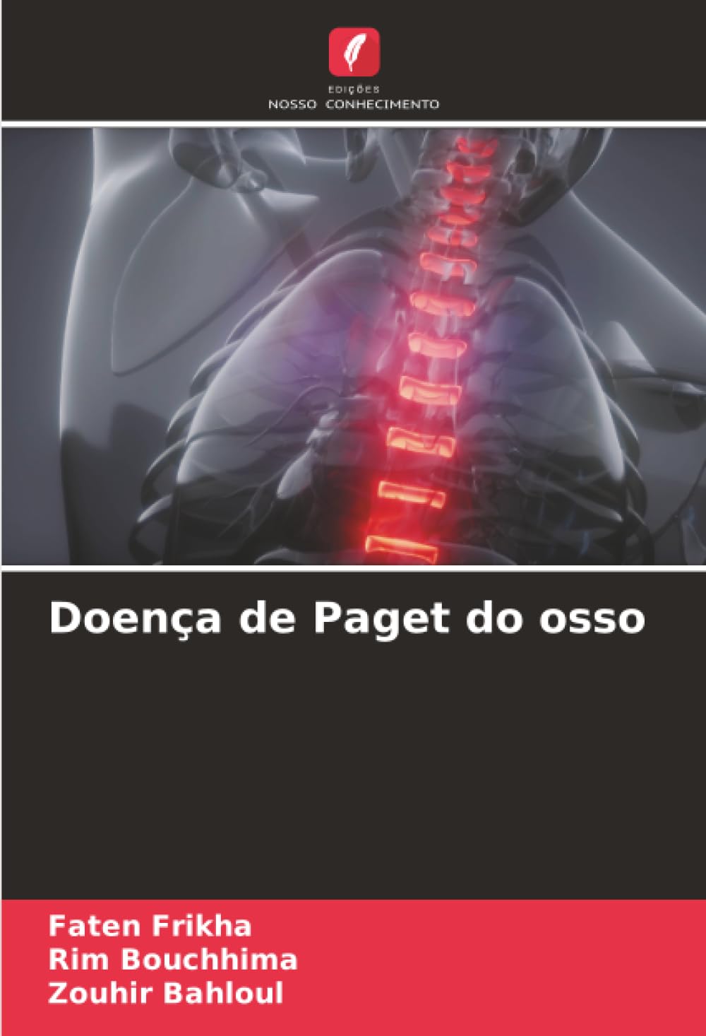 Doença de Paget do osso Medicine