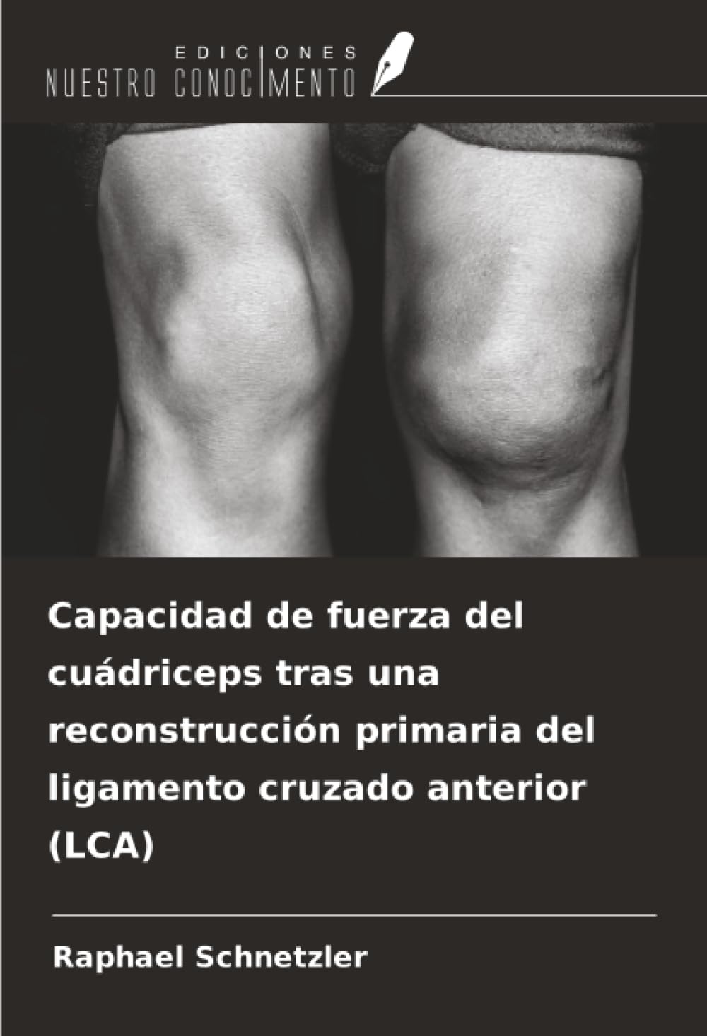 Capacidad de fuerza del cuádriceps tras una reconstrucción primaria del ligamento cruzado anterior (LCA) Medicine