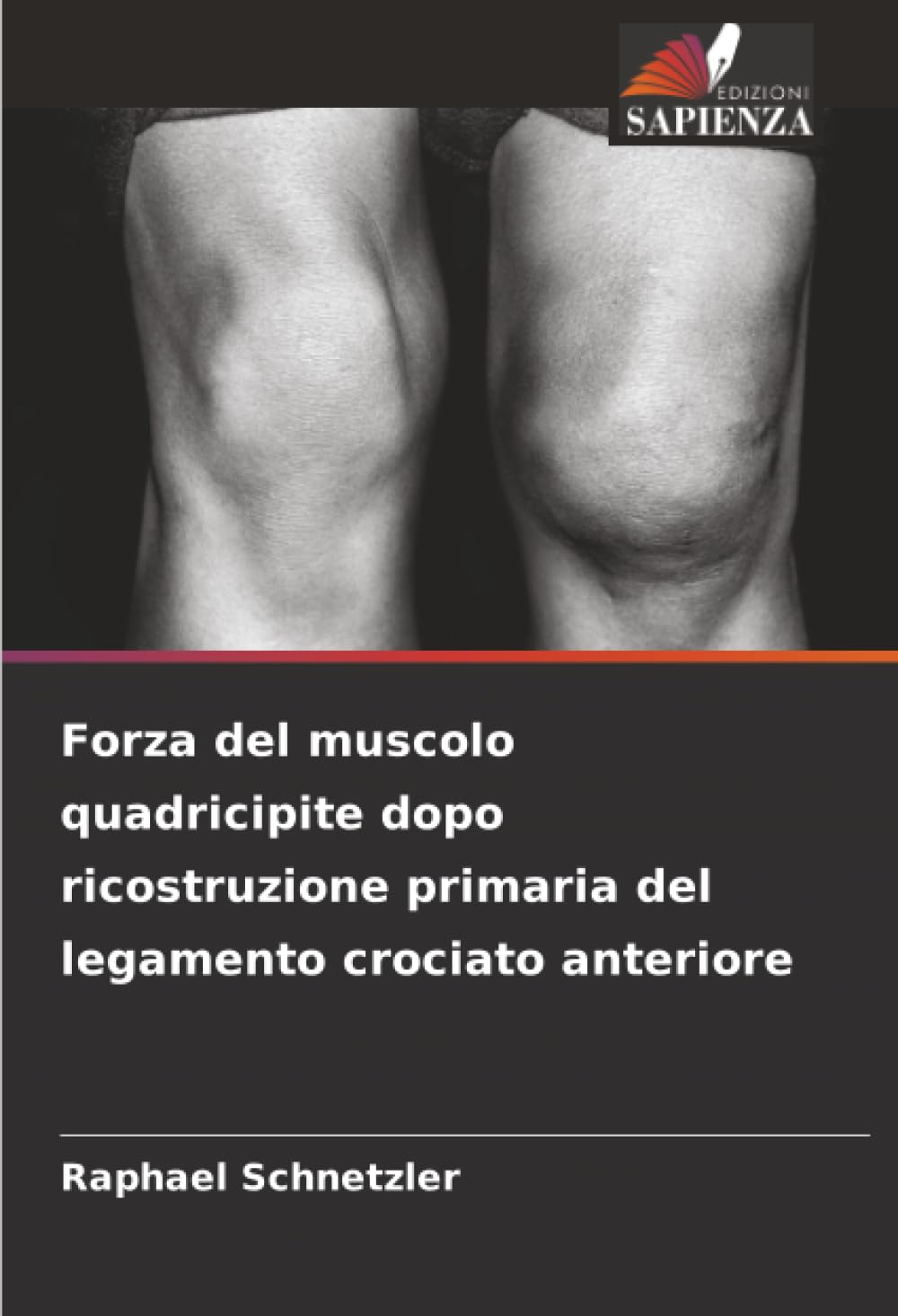 Forza del muscolo quadricipite dopo ricostruzione primaria del legamento crociato anteriore Medicine