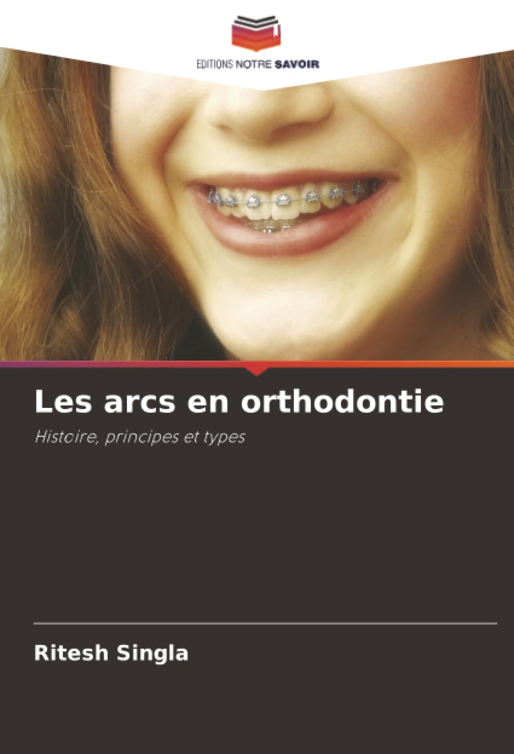 Les arcs en orthodontie: Histoire, principes et types Medicine