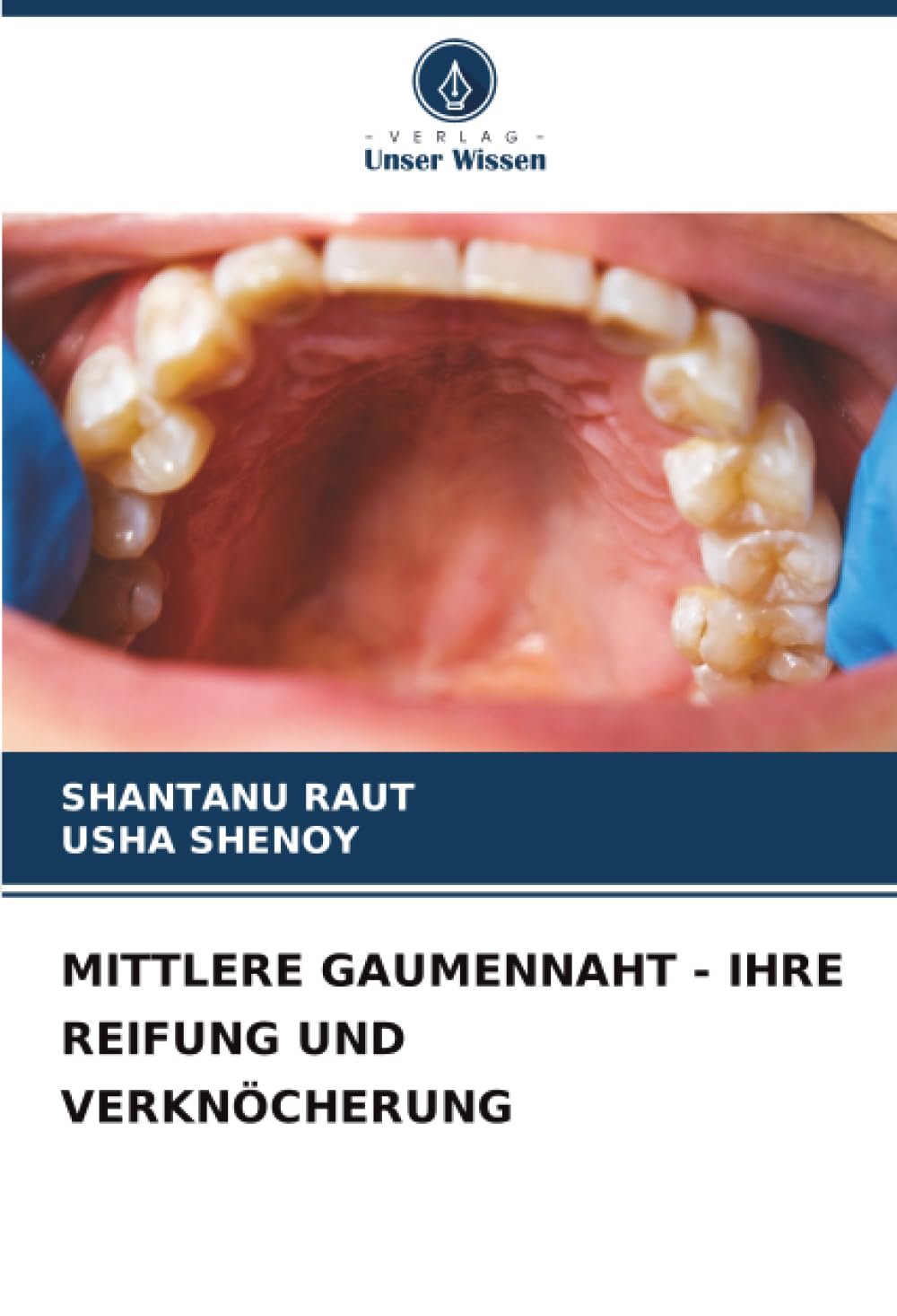 MITTLERE GAUMENNAHT - IHRE REIFUNG UND VERKNÖCHERUNG Medicine
