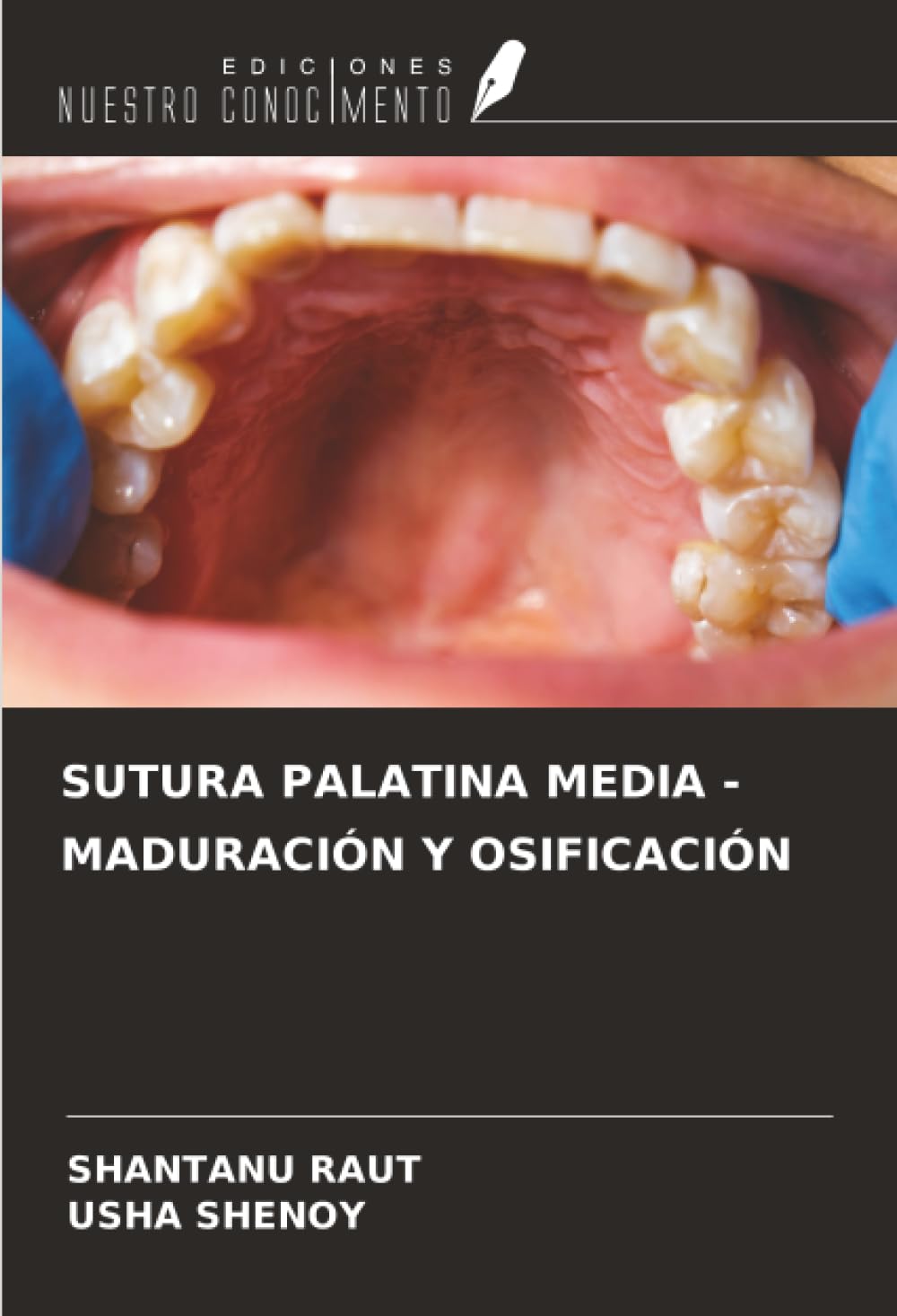 SUTURA PALATINA MEDIA - MADURACIÓN Y OSIFICACIÓN Medicine