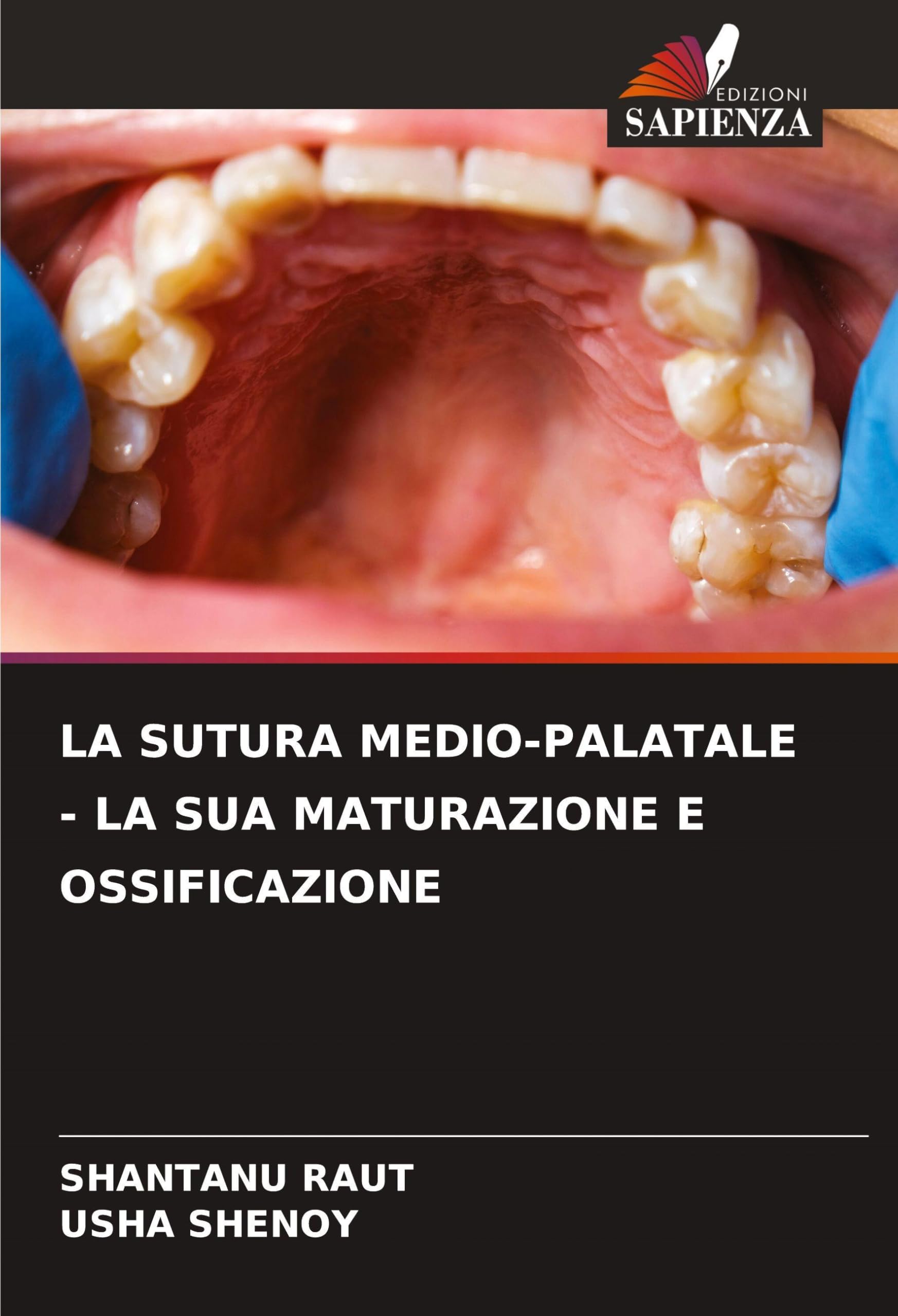 LA SUTURA MEDIO-PALATALE - LA SUA MATURAZIONE E OSSIFICAZIONE Medicine