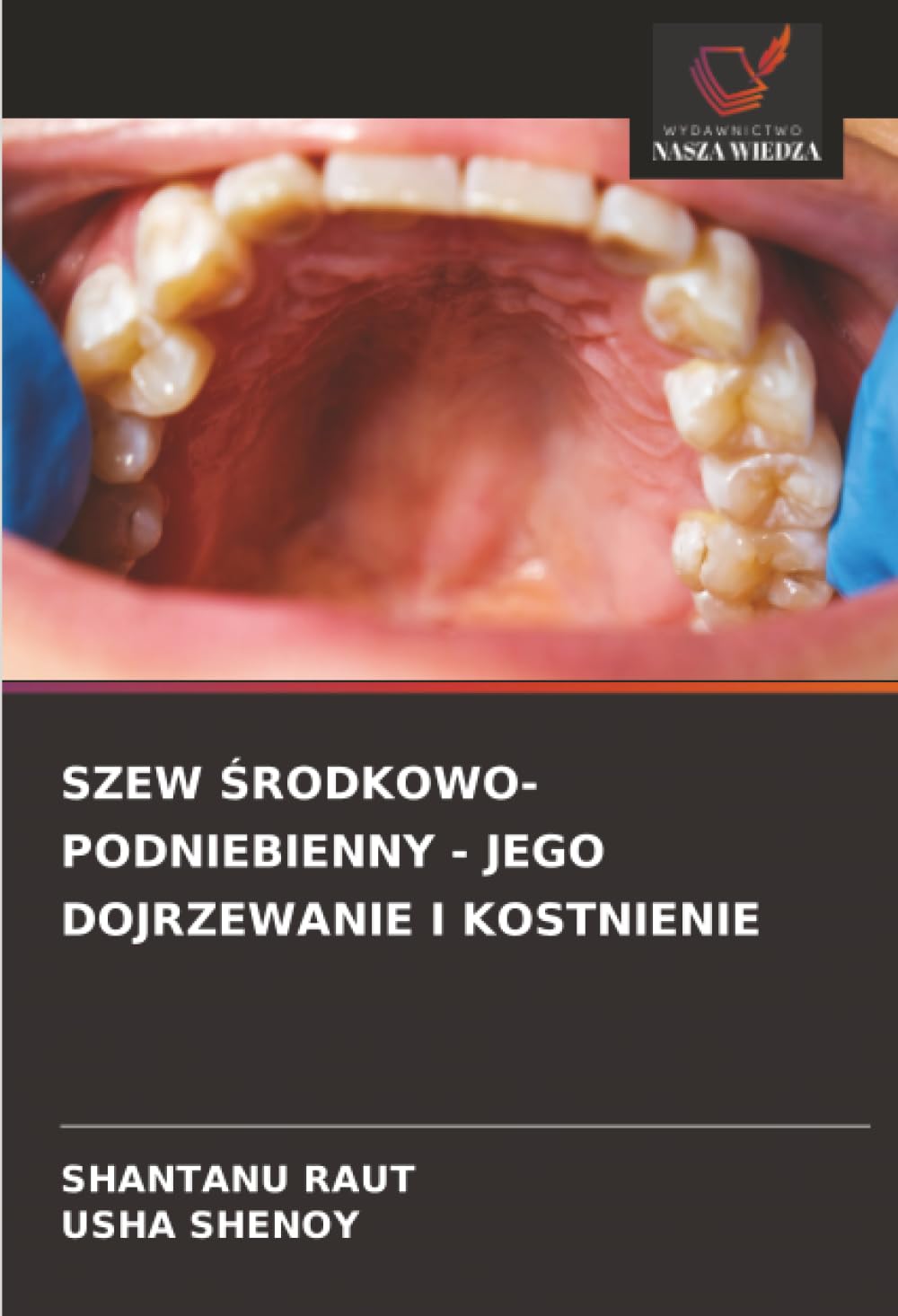 SZEW ¿RODKOWO-PODNIEBIENNY - JEGO DOJRZEWANIE I KOSTNIENIE Medicine