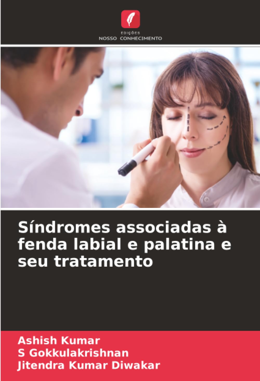 Síndromes associadas à fenda labial e palatina e seu tratamento Medicine