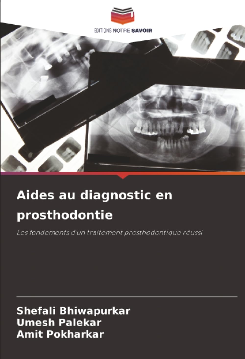 Aides au diagnostic en prosthodontie Medicine