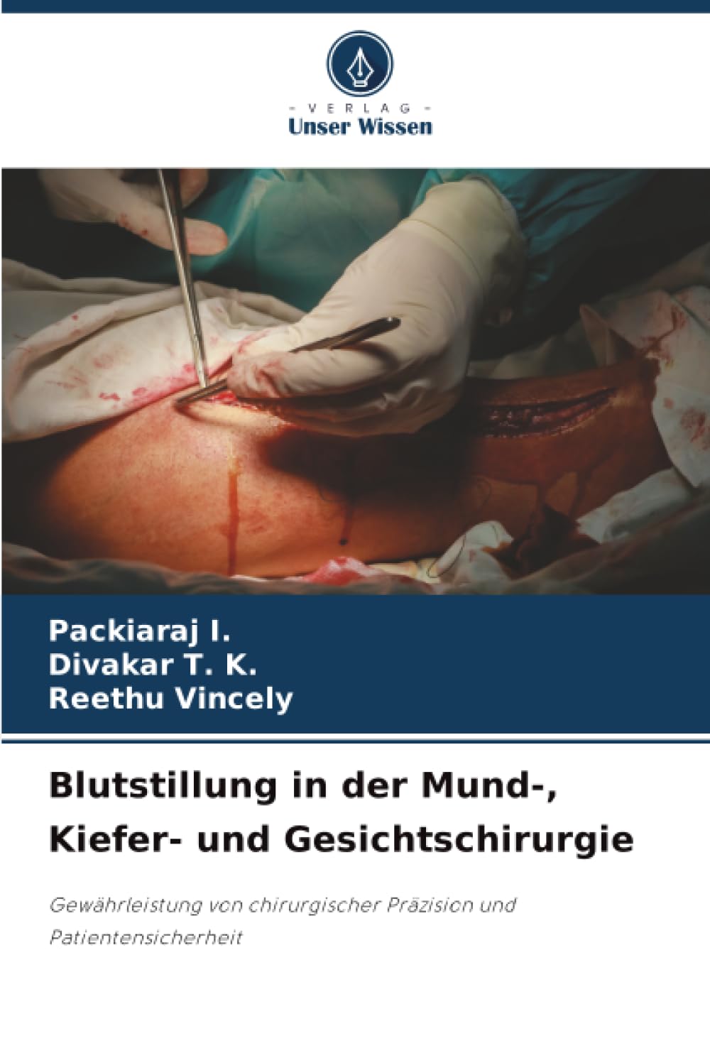 Blutstillung in der Mund-, Kiefer- und Gesichtschirurgie Medicine