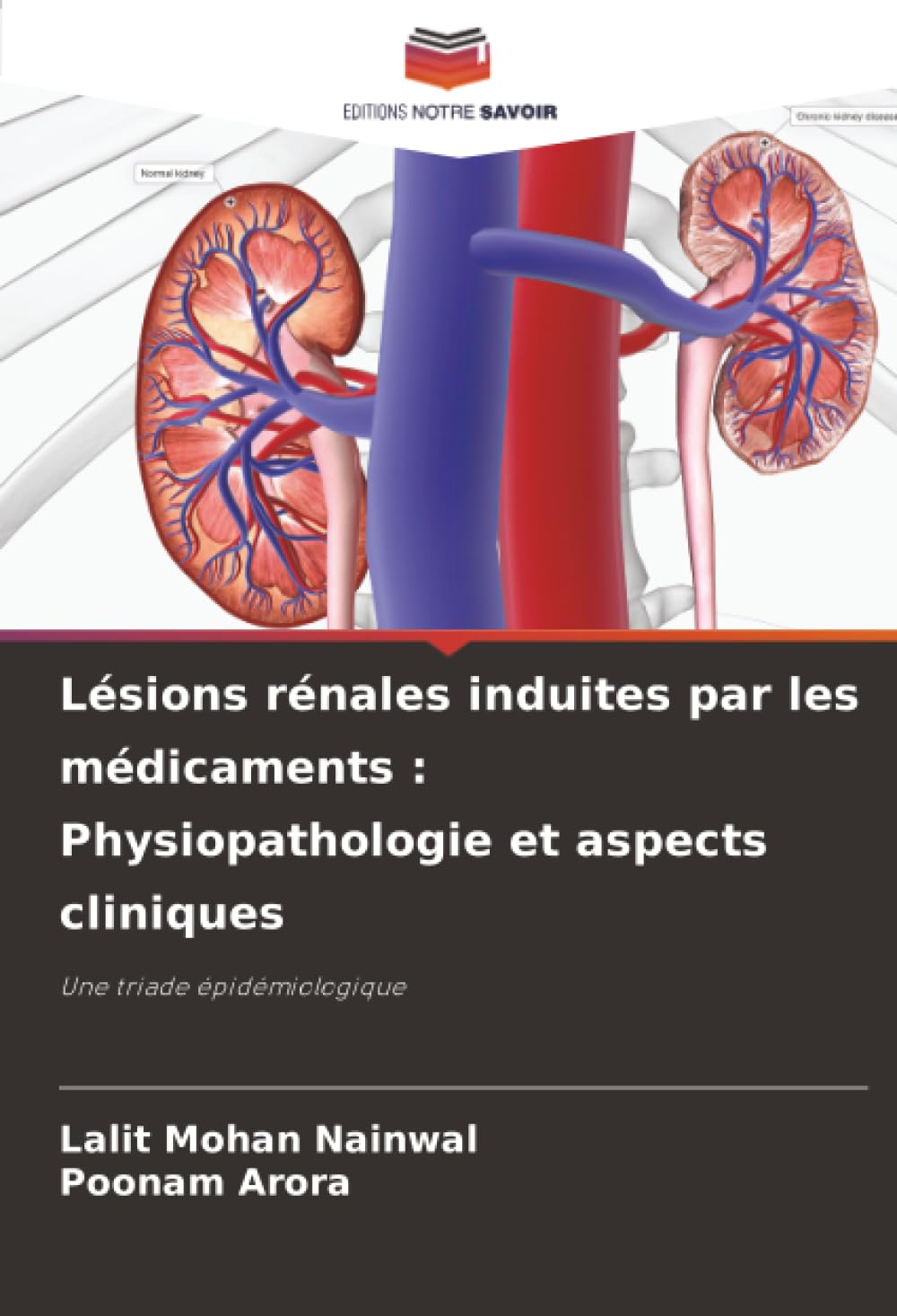 Lésions rénales induites par les médicaments : Physiopathologie et aspects cliniques Law