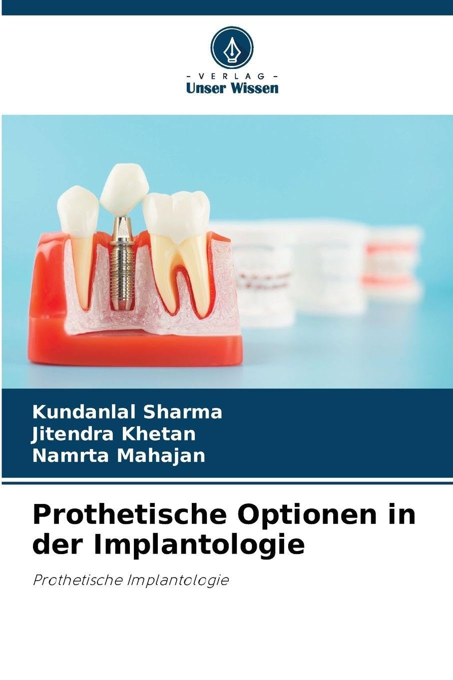 Prothetische Optionen in der Implantologie Medicine