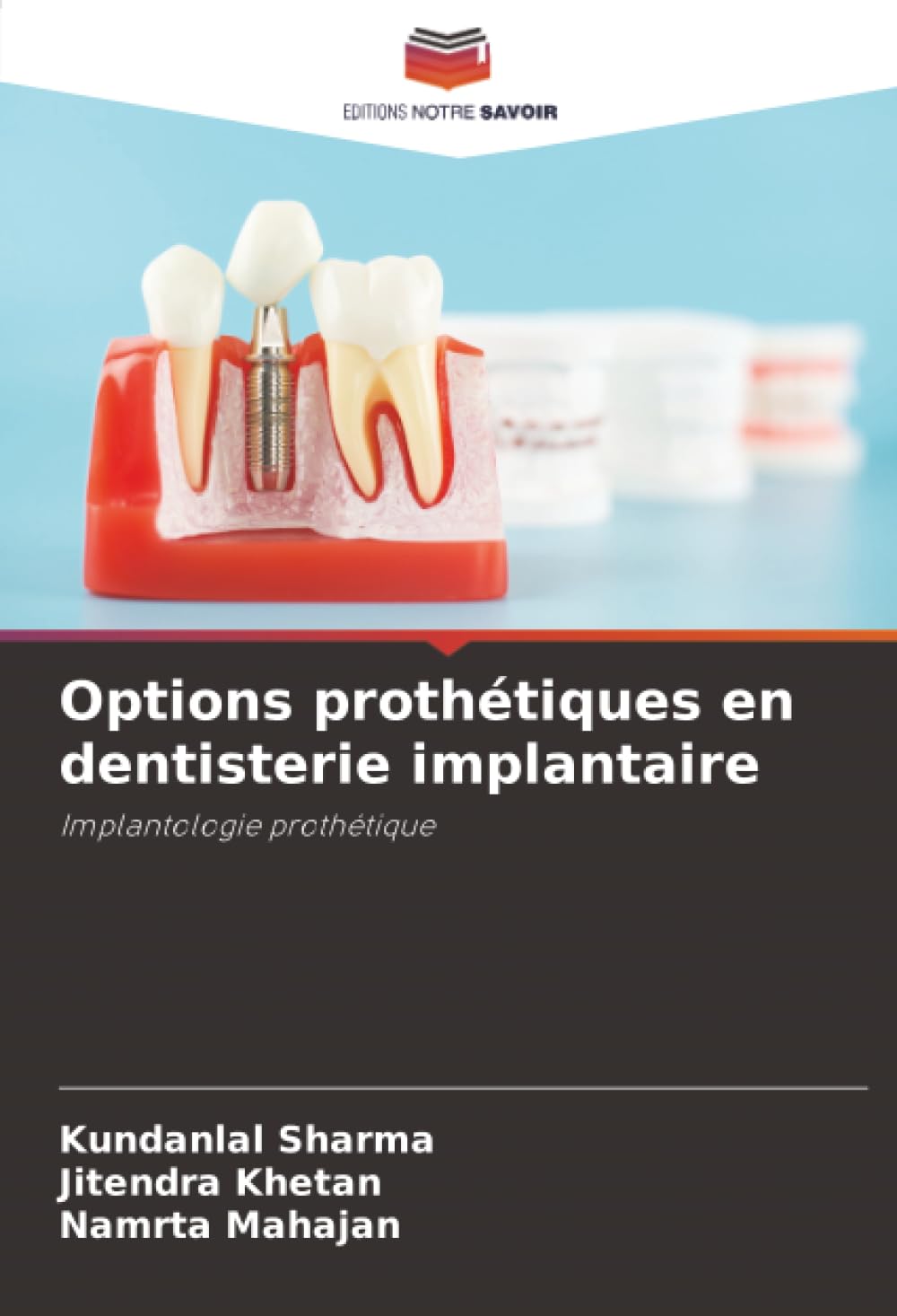 Options prothétiques en dentisterie implantaire: Implantologie prothétique Medicine