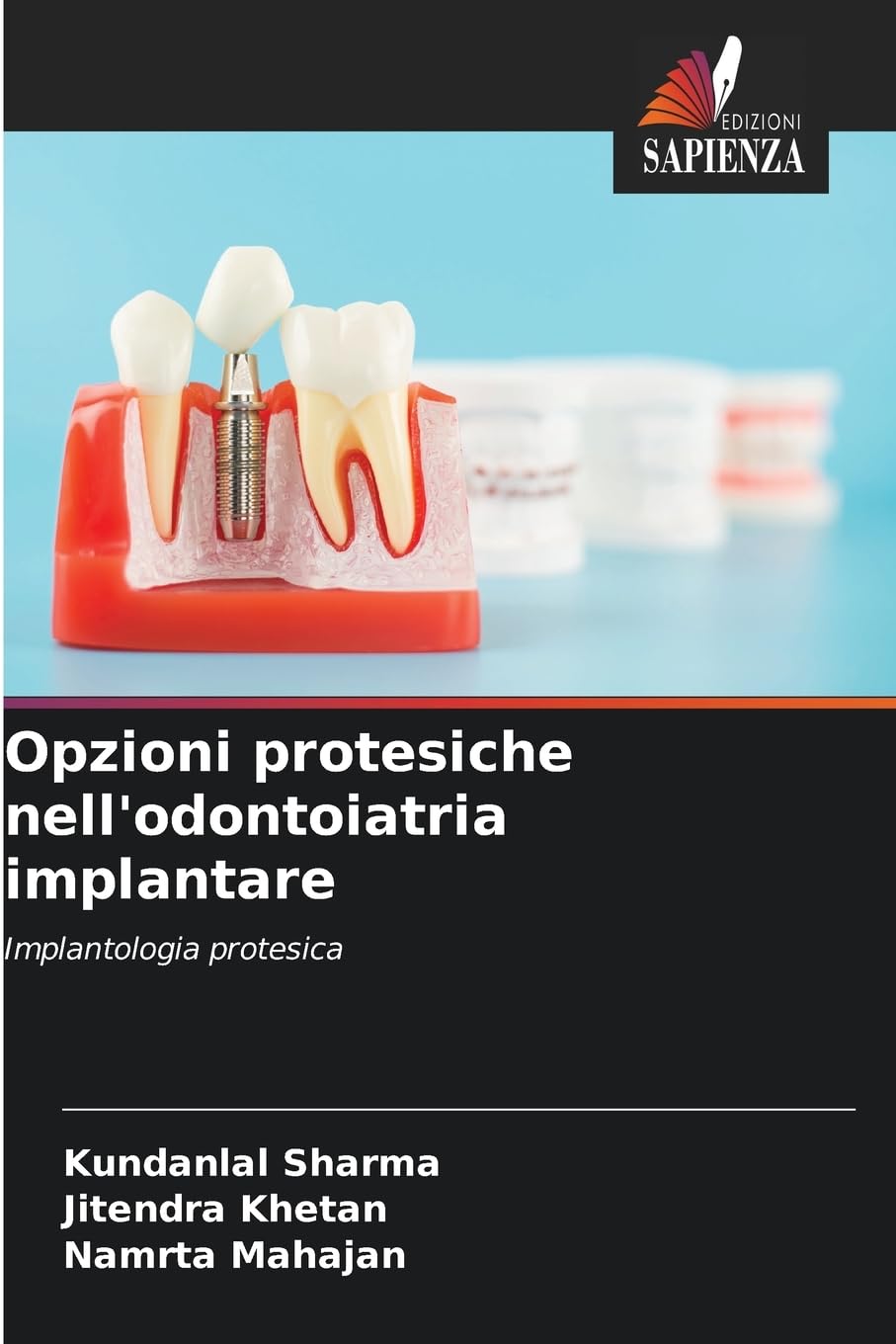 Opzioni protesiche nell'odontoiatria implantare Medicine