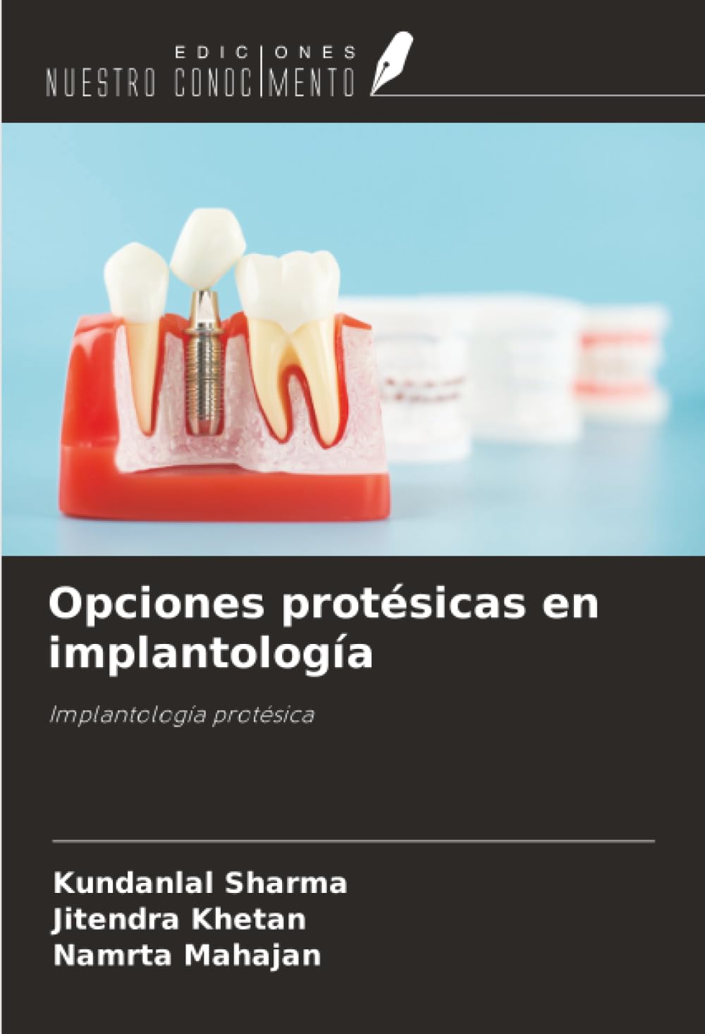 Opciones protésicas en implantología Medicine