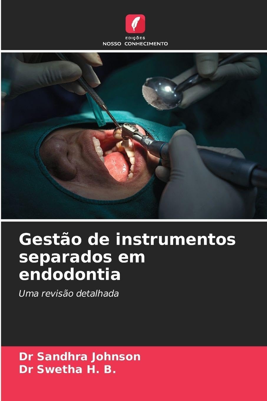 Gestão de instrumentos separados em endodontia Medicine