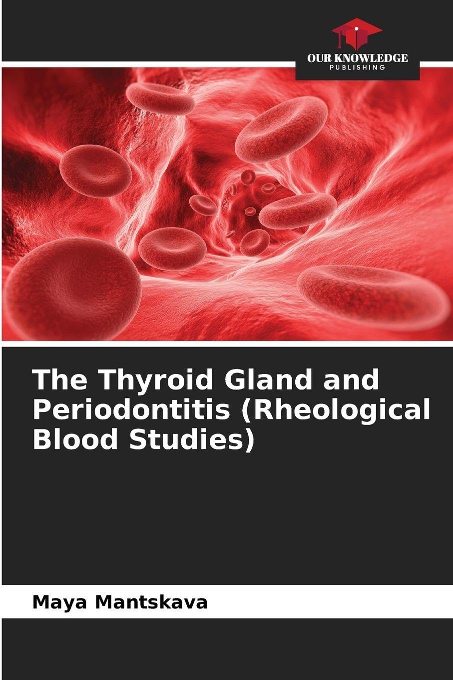 The Thyroid Gland and Periodontitis (Rheological Blood Studies) Medicine