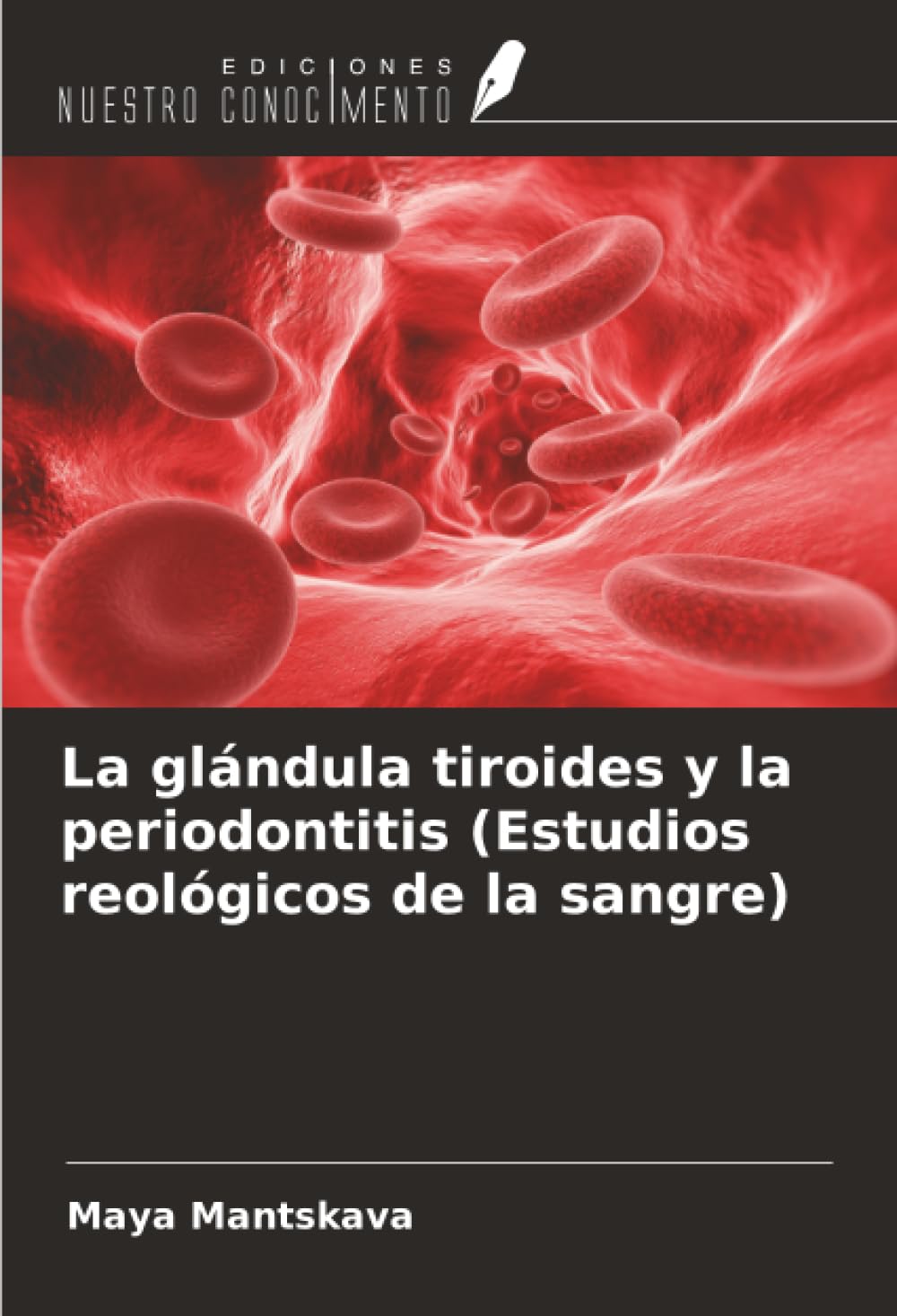 La glándula tiroides y la periodontitis (Estudios reológicos de la sangre) Medicine