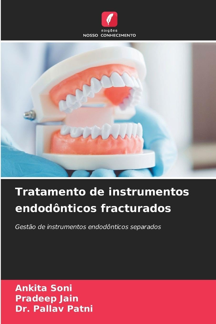 Tratamento de instrumentos endodônticos fracturados Medicine