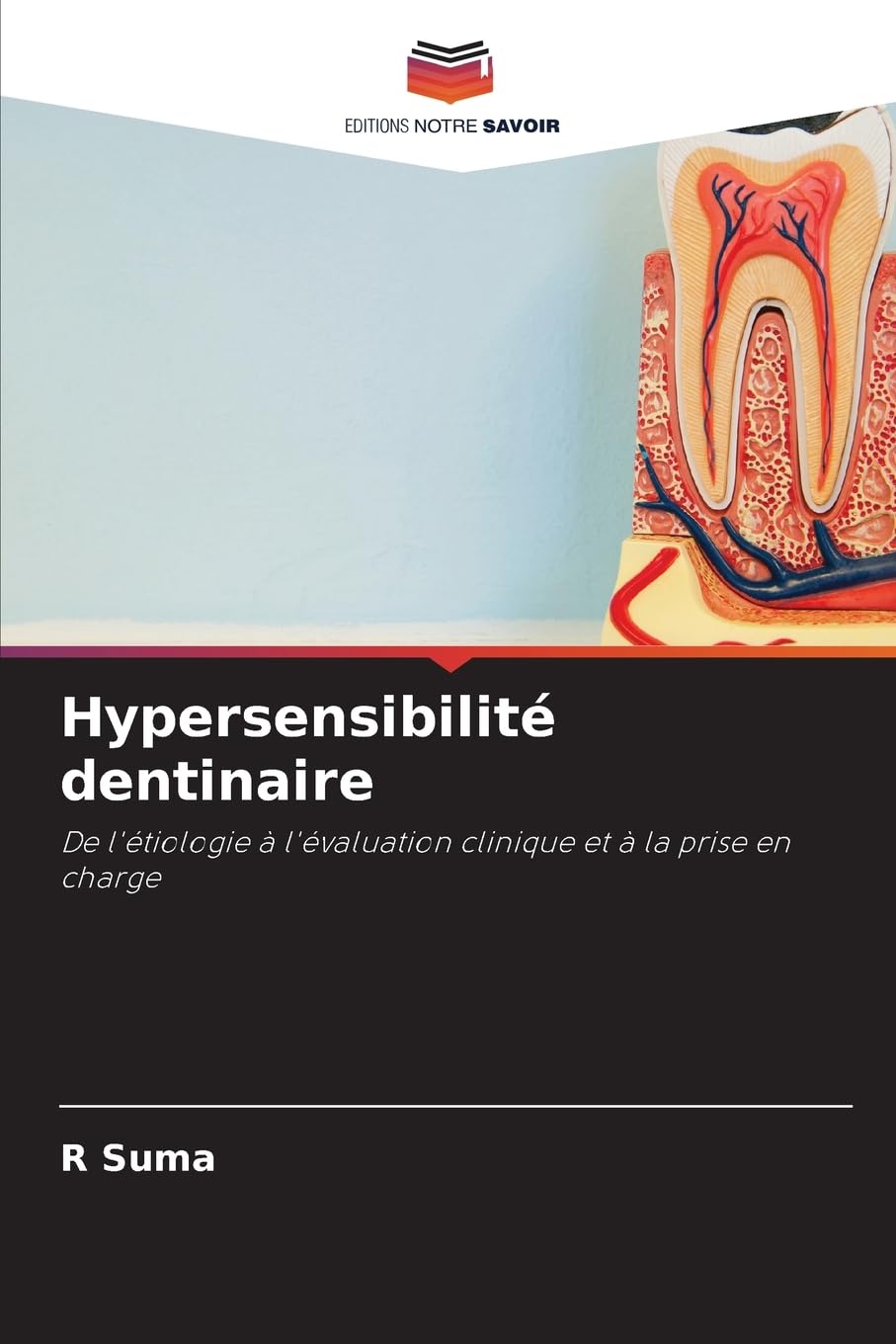 Hypersensibilité dentinaire: De l'étiologie à l'évaluation clinique et à la prise en charge Medicine