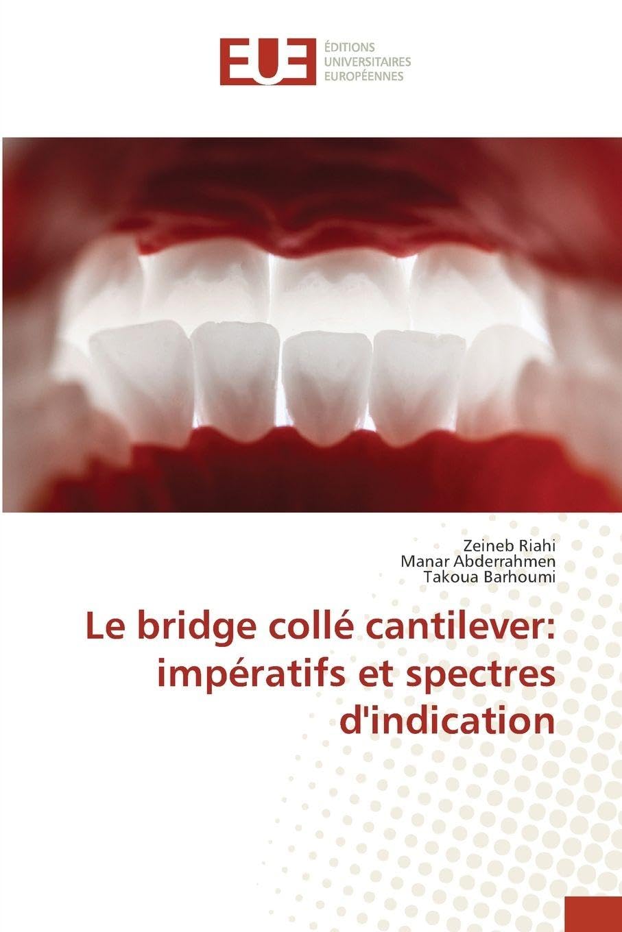 Le bridge collé cantilever: impératifs et spectres d'indication Medicine