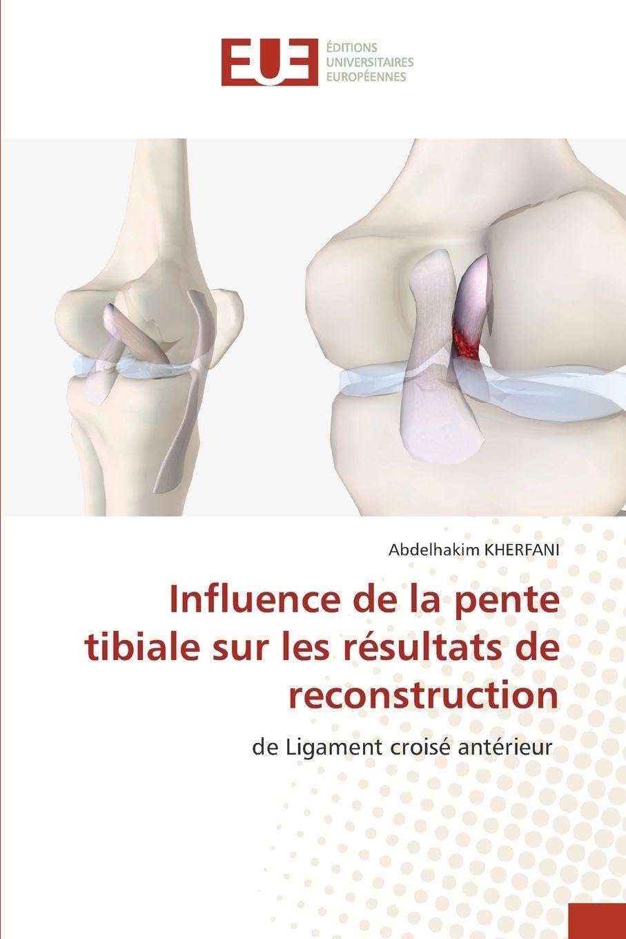 Influence de la pente tibiale sur les résultats de reconstruction Medicine