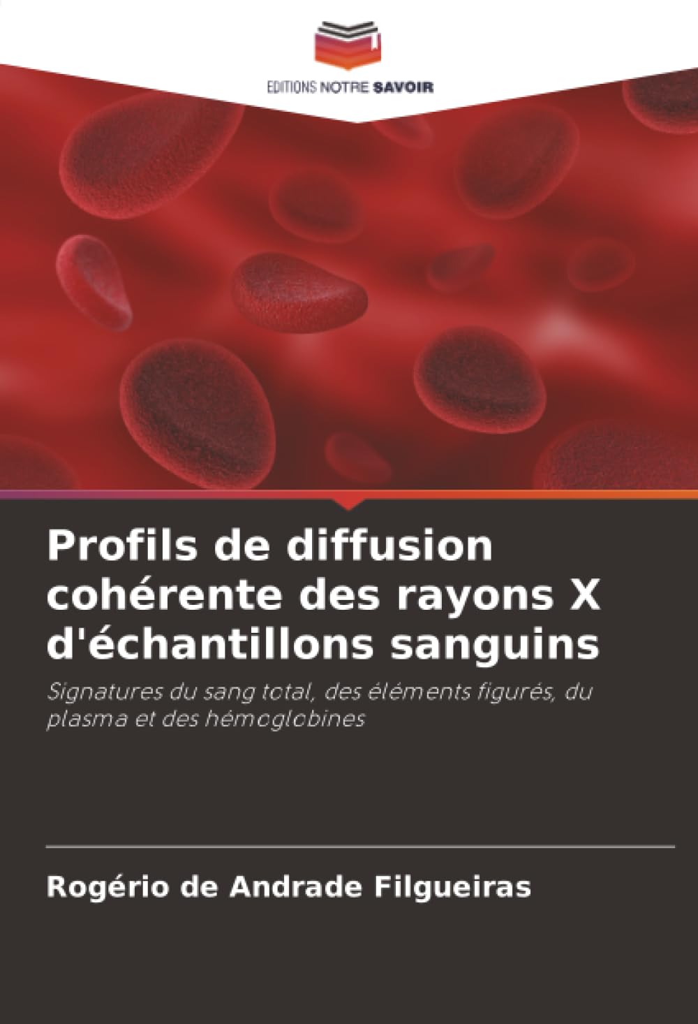 Profils de diffusion cohérente des rayons X d'échantillons sanguins: Signatures du sang total, des éléments figurés, du plasma et des hémoglobines Natural Sciences