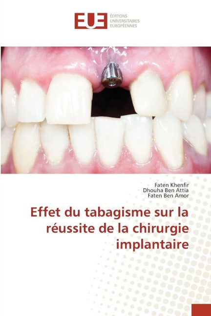 Effet du tabagisme sur la réussite de la chirurgie implantaire Medicine