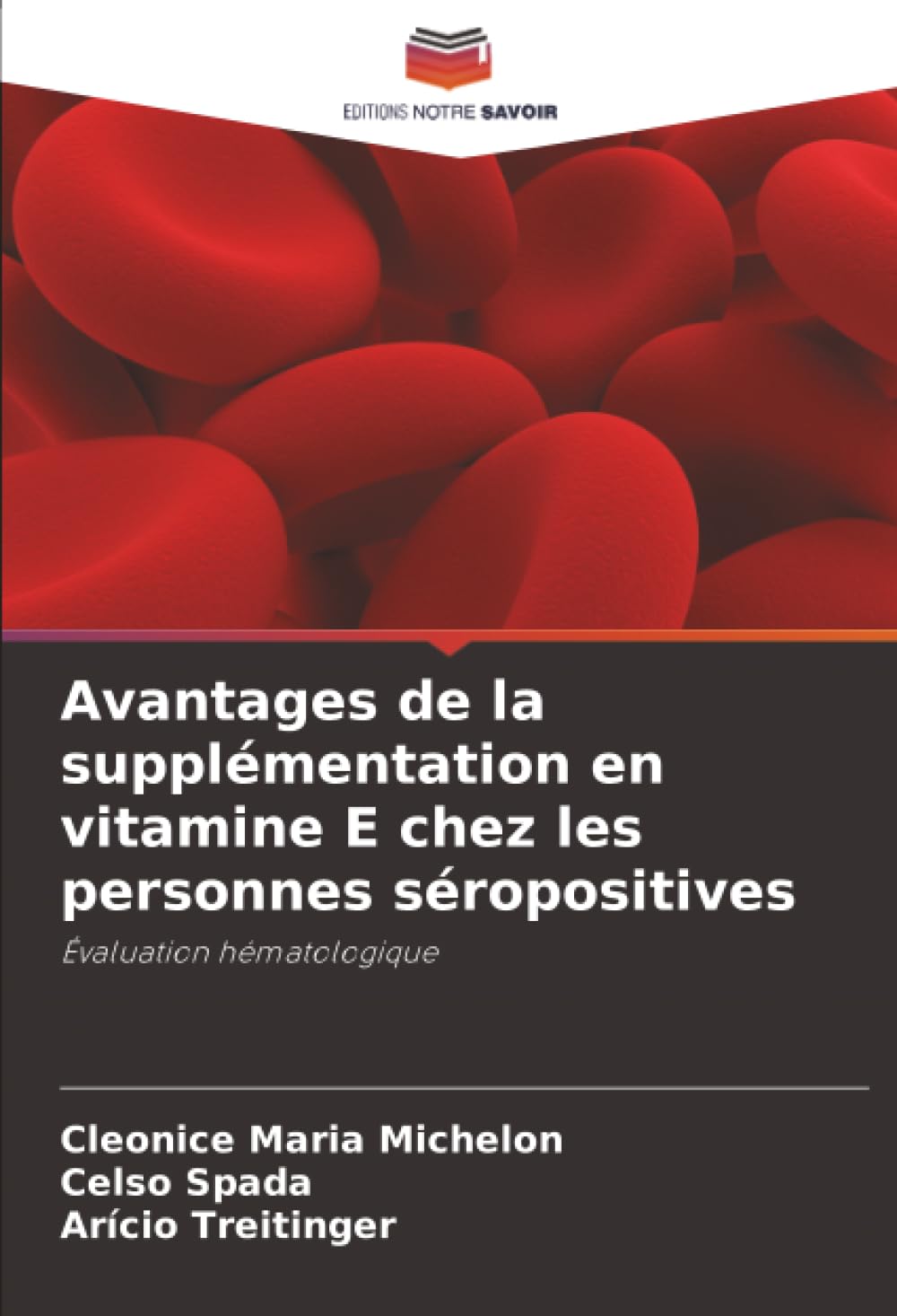 Avantages de la supplémentation en vitamine E chez les personnes séropositives Medicine