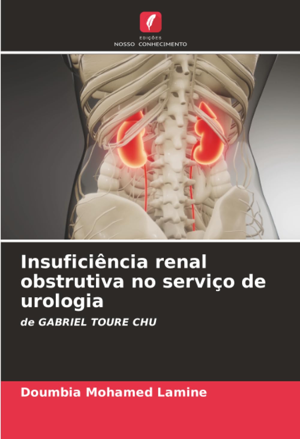 Insuficiência renal obstrutiva no serviço de urologia Medicine