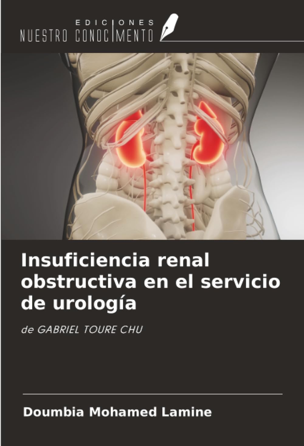 Insuficiencia renal obstructiva en el servicio de urología Medicine