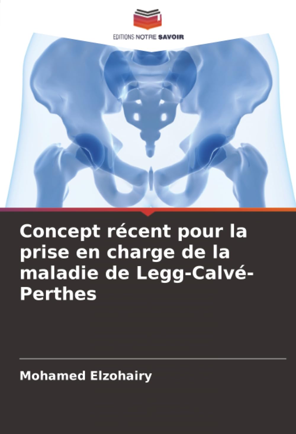 Concept récent pour la prise en charge de la maladie de Legg-Calvé-Perthes Medicine