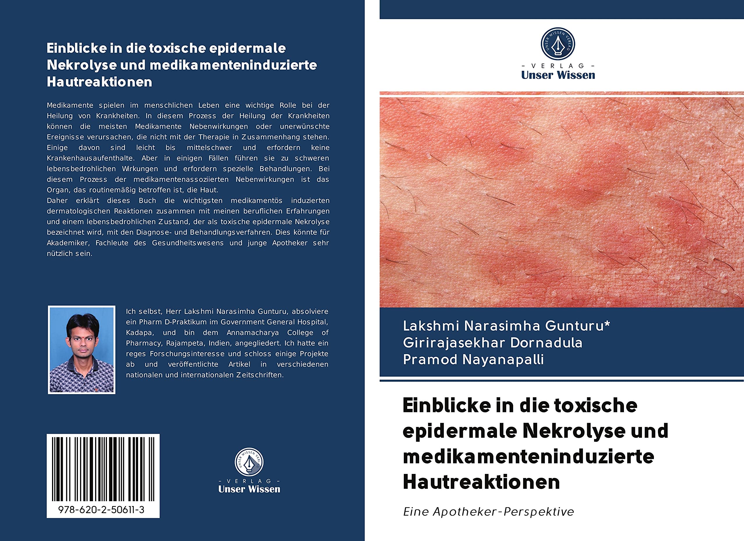 Einblicke in die toxische epidermale Nekrolyse und medikamenteninduzierte Hautreaktionen: Eine Apotheker-Perspektive Medicine